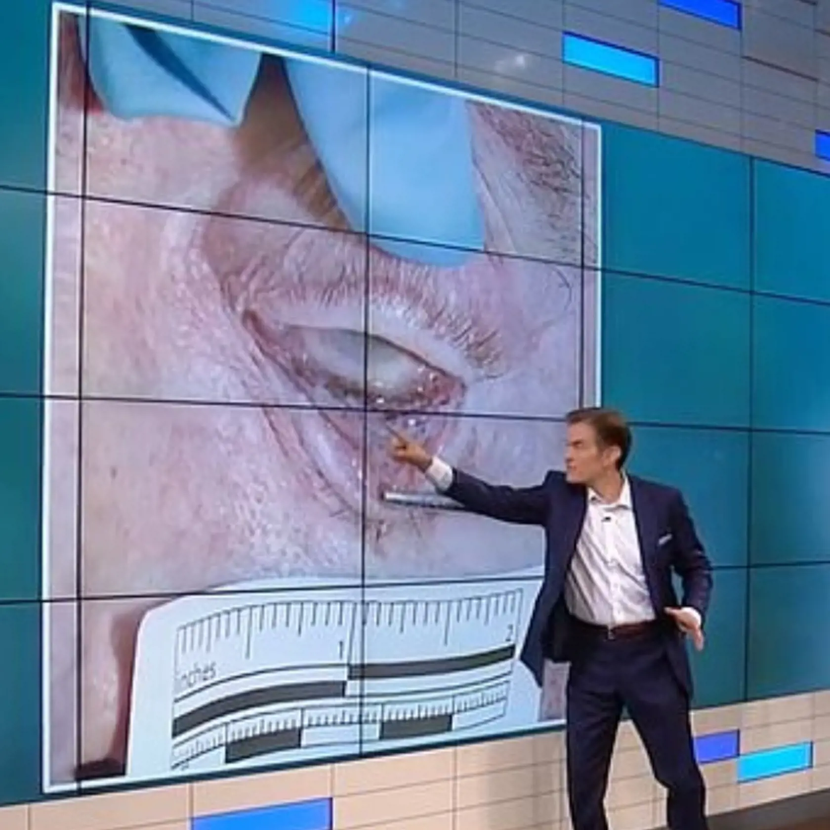 Prasknuté cievky v oku sú podľa Badena znakom toho, že Epsteina niekto zaškrtil.