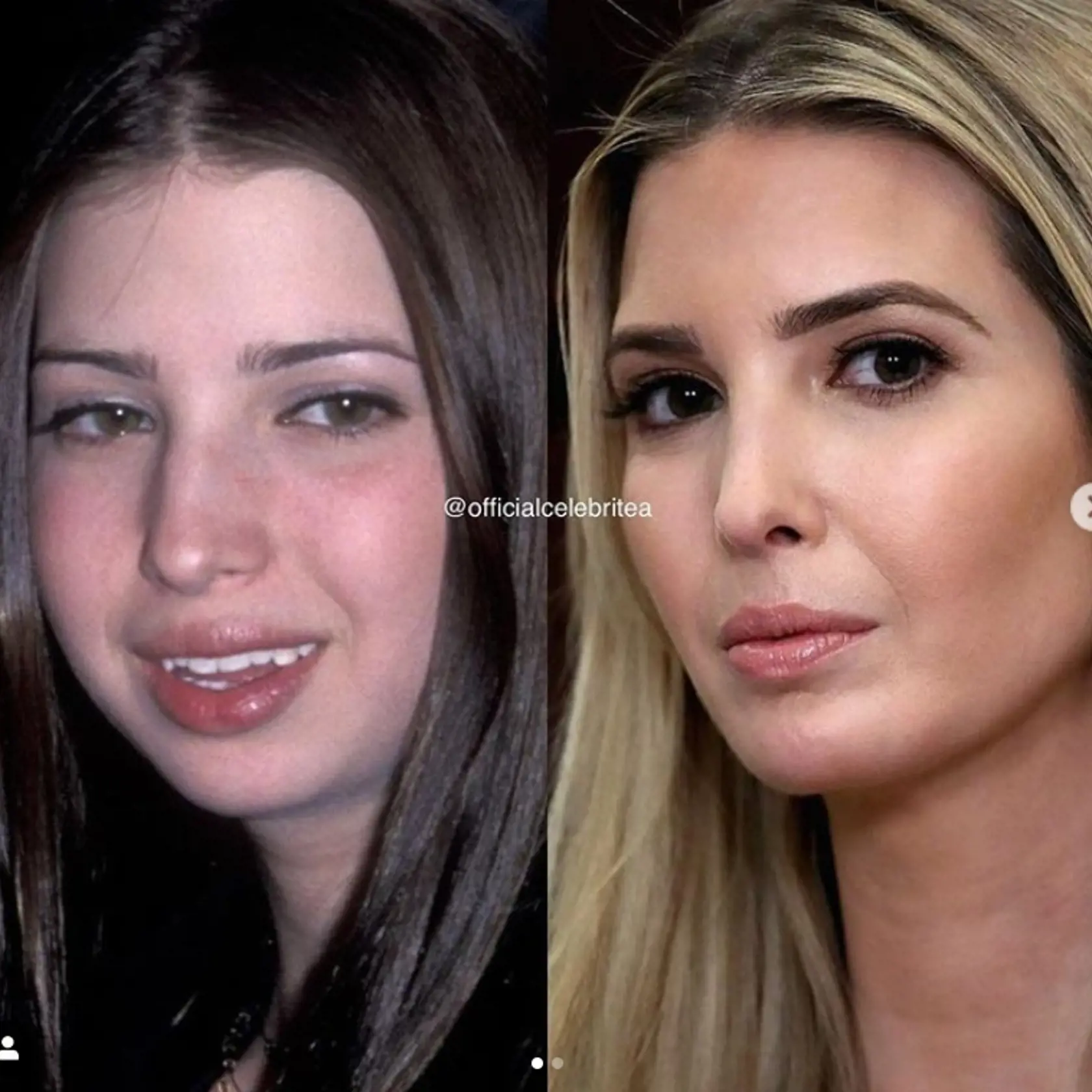 Blond vlasy, dokonalé línie tváre či perfektné telo neboli vždy jej prednosťou. Ivanku si totiž v mladom veku vzali do parády šikovní plastickí chirurgovia.