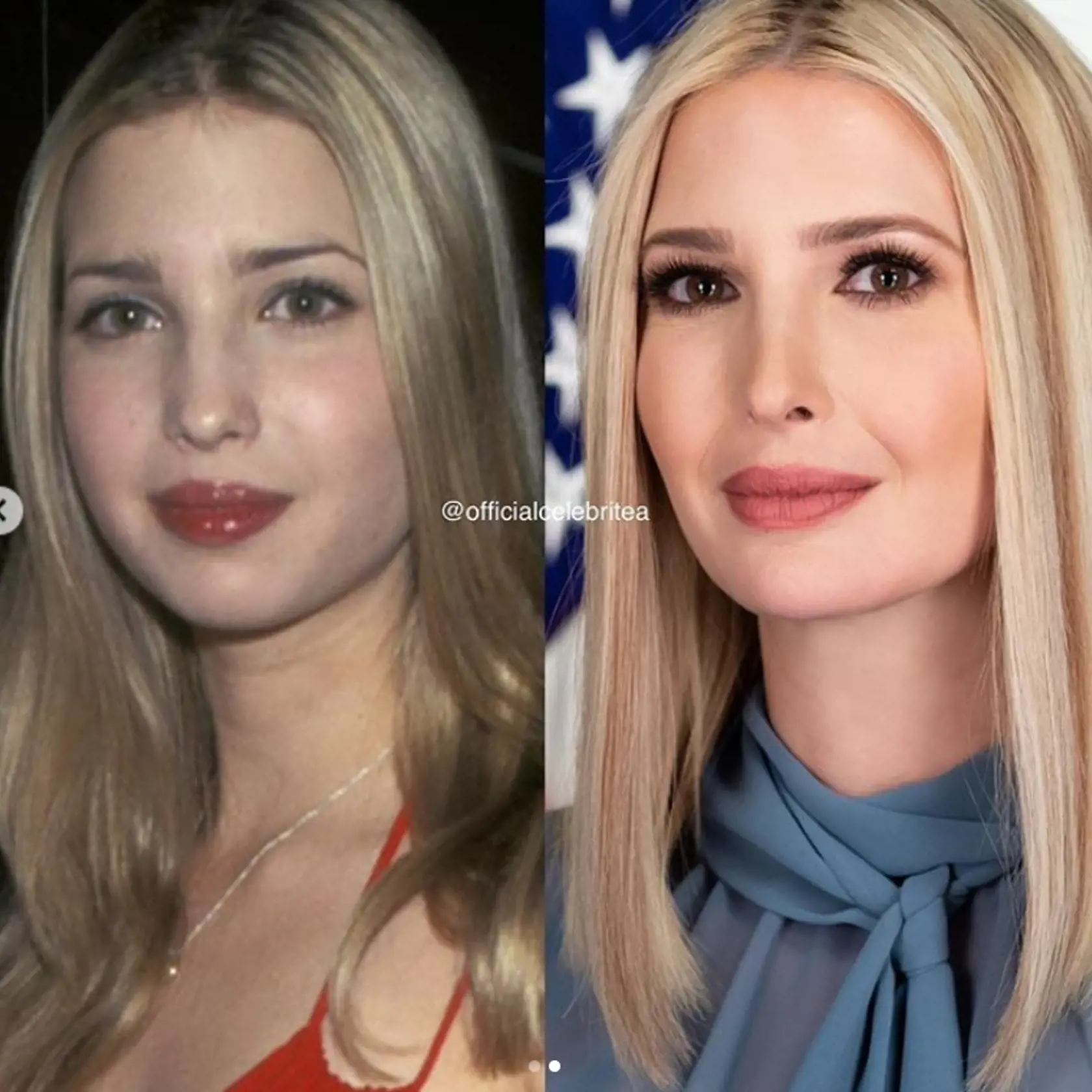 Blond vlasy, dokonalé línie tváre či perfektné telo neboli vždy jej prednosťou. Ivanku si totiž v mladom veku vzali do parády šikovní plastickí chirurgovia.