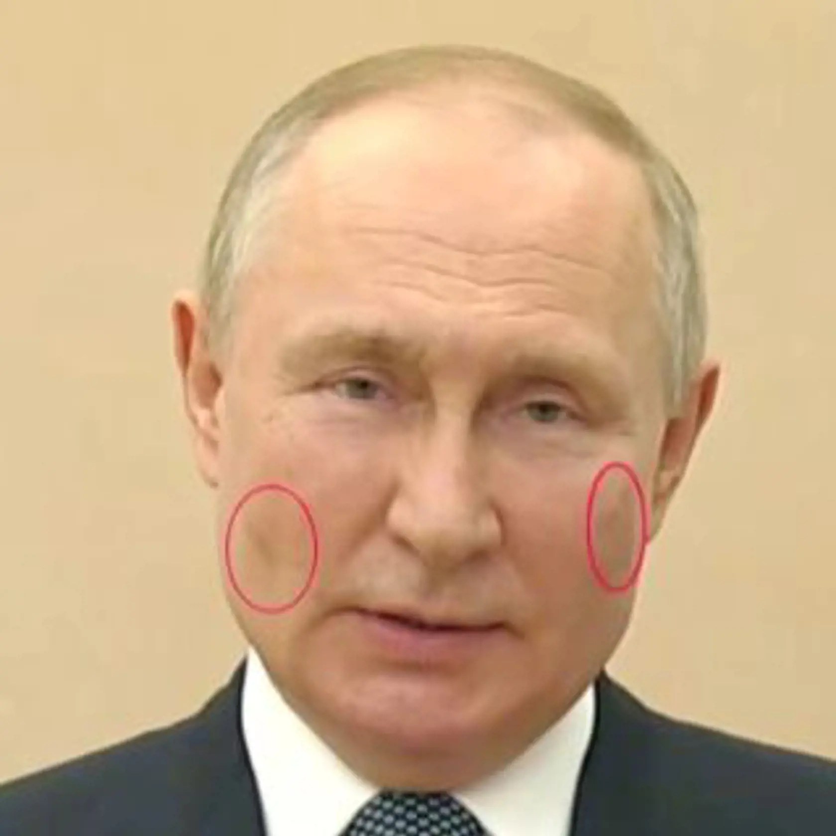 Vladimin Putin zrejme vynechal hokejový zápas pre zlý zdravotný stav, naposledy mal totiž na tvári podivné škvrny, čo si všimli aj zahraničné médiá.