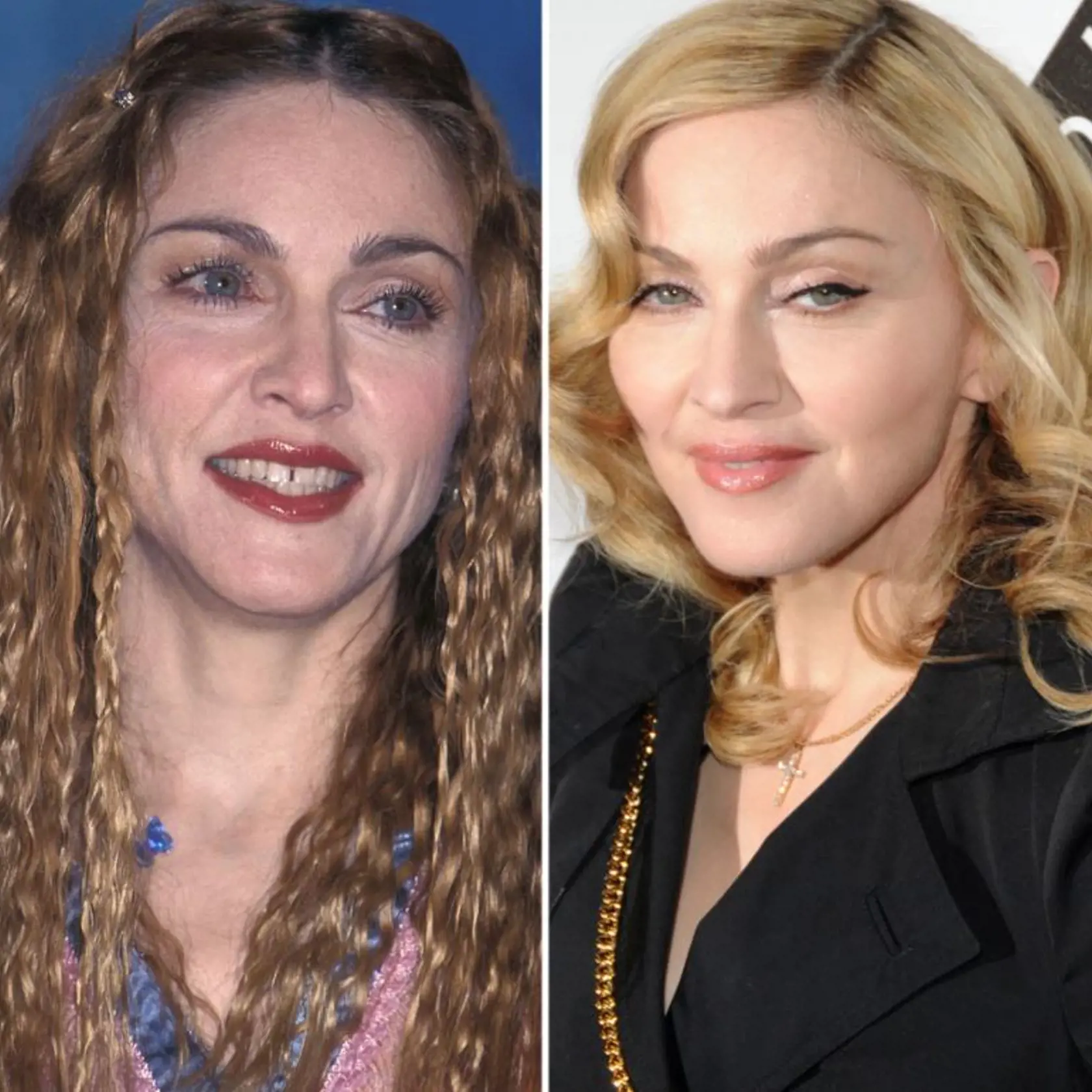 Madonna vyzerá lepšie, než v mladosti.