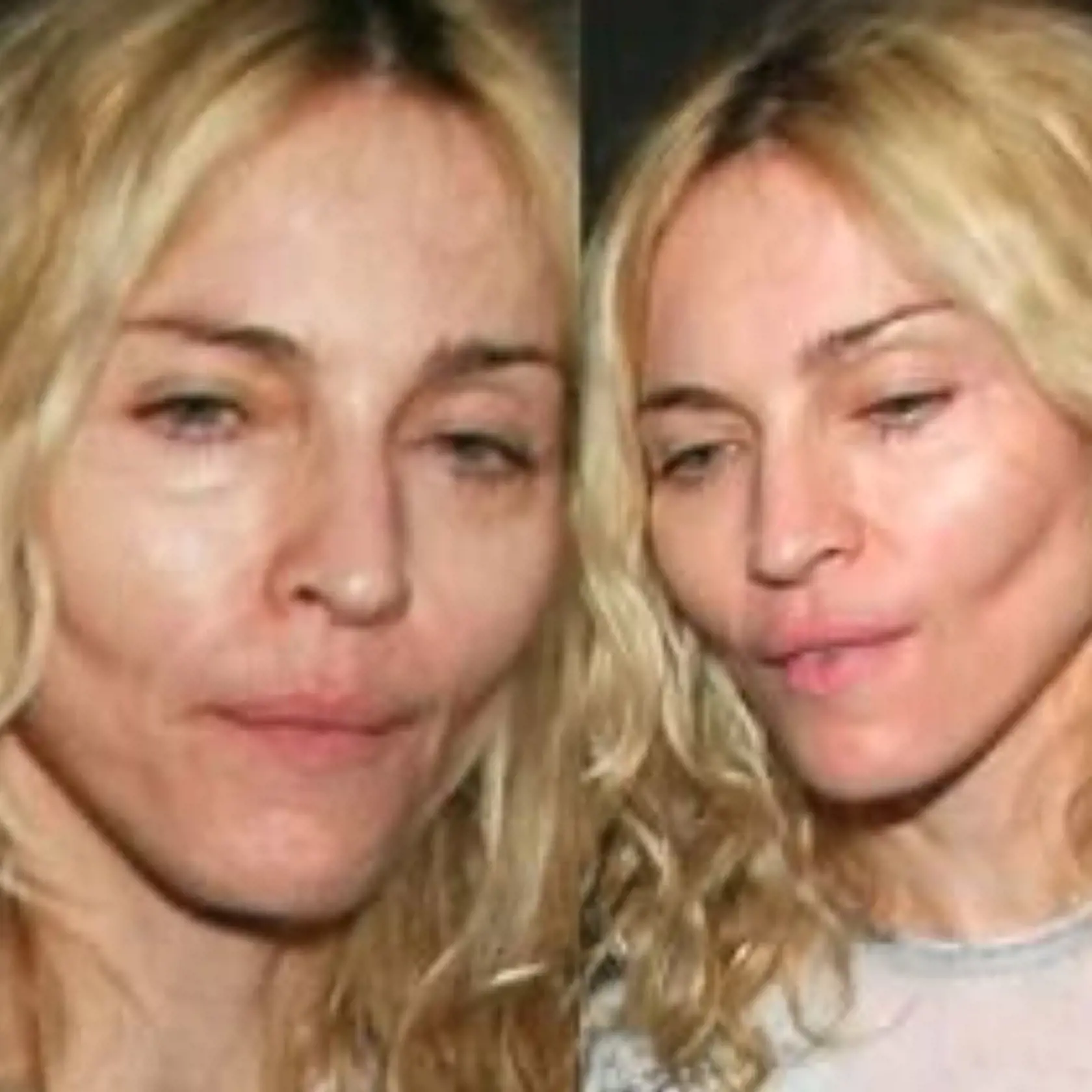 Madonna údajne podstúpila facelift.