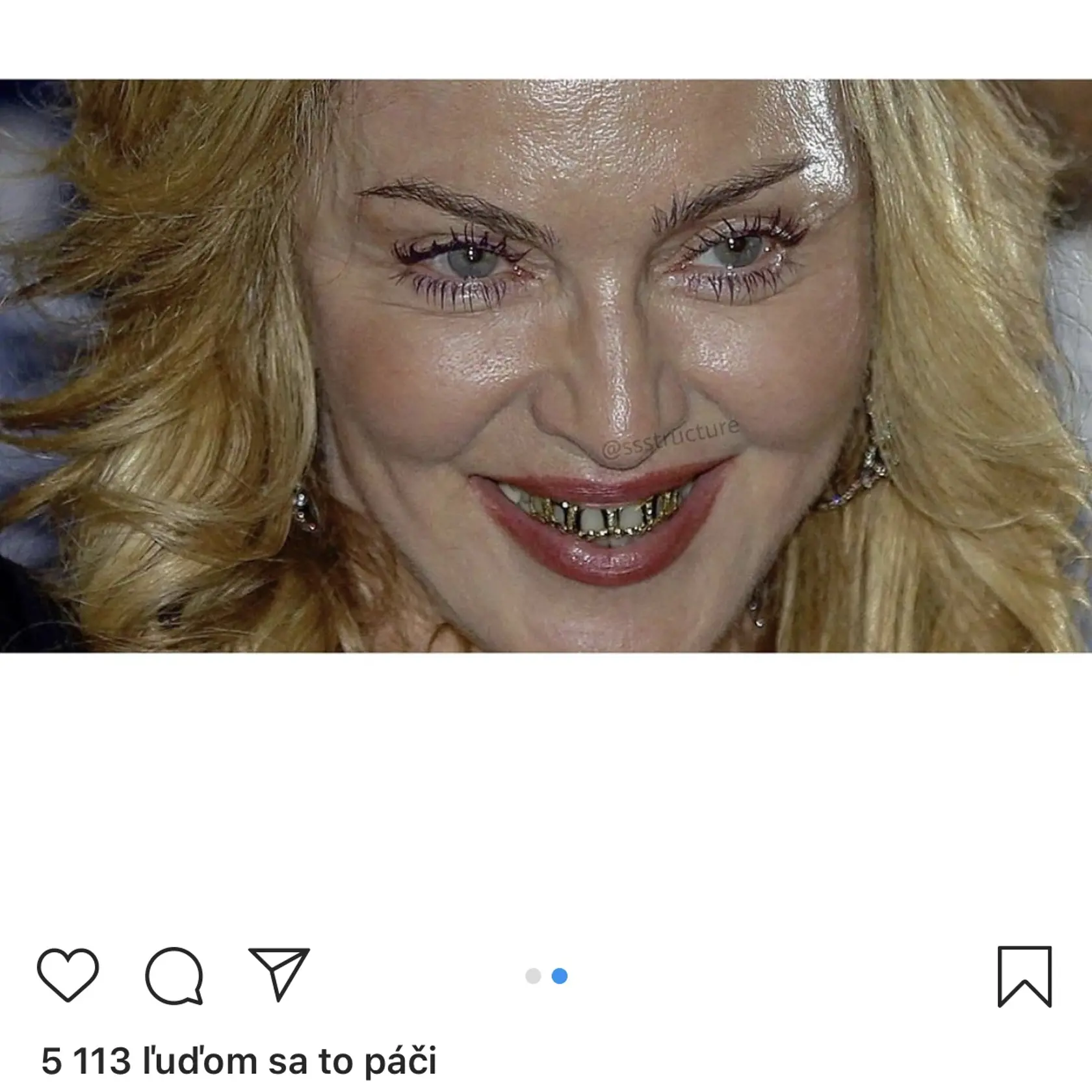 Madonna by zrejme mohla začať robiť niečo so svojou mastnou pleťou.