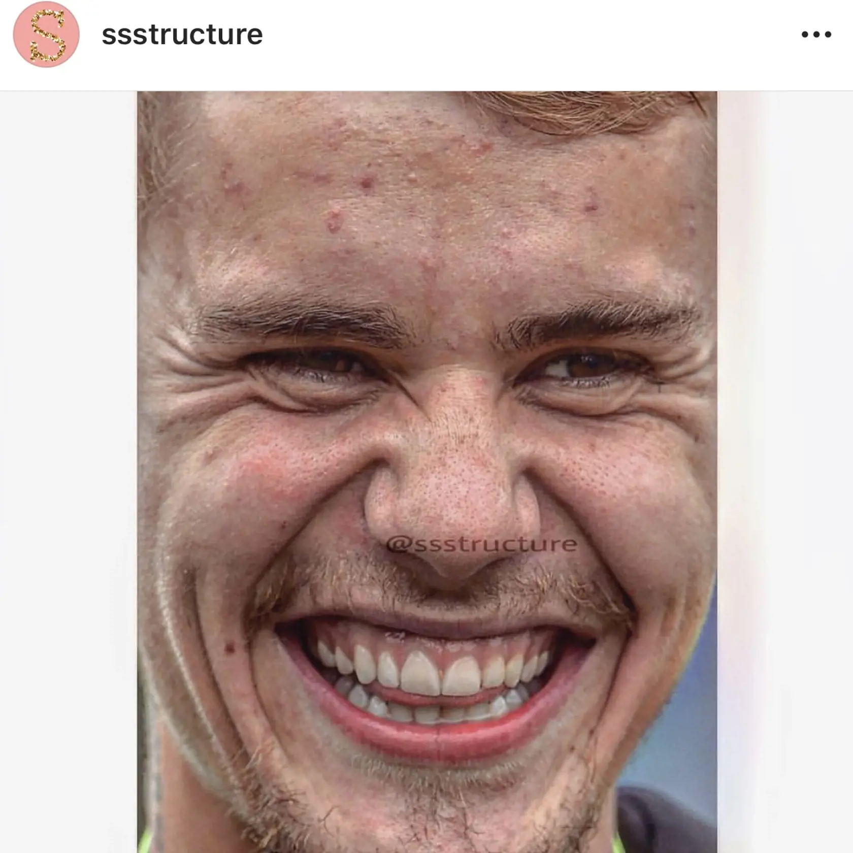 Tak to, chceli by ste mať Justina Biebera doma aj teraz? Aj s jeho vyrážkami?