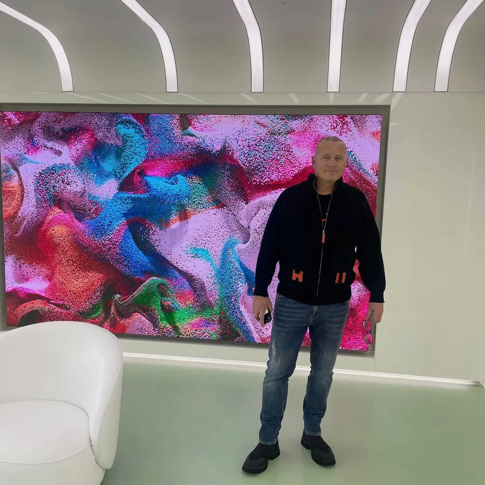 Boris Kollár zverejnil prvú fotku po transplantácii vlasov.