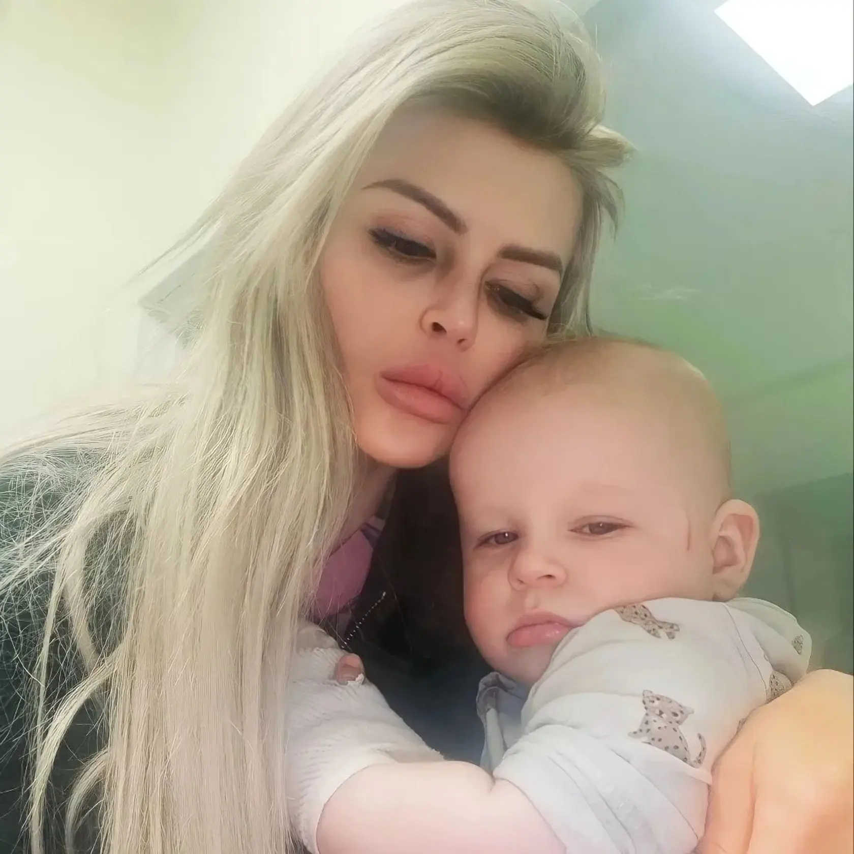 O malého Rockyho sa postarali v žilinskej nemocnici.