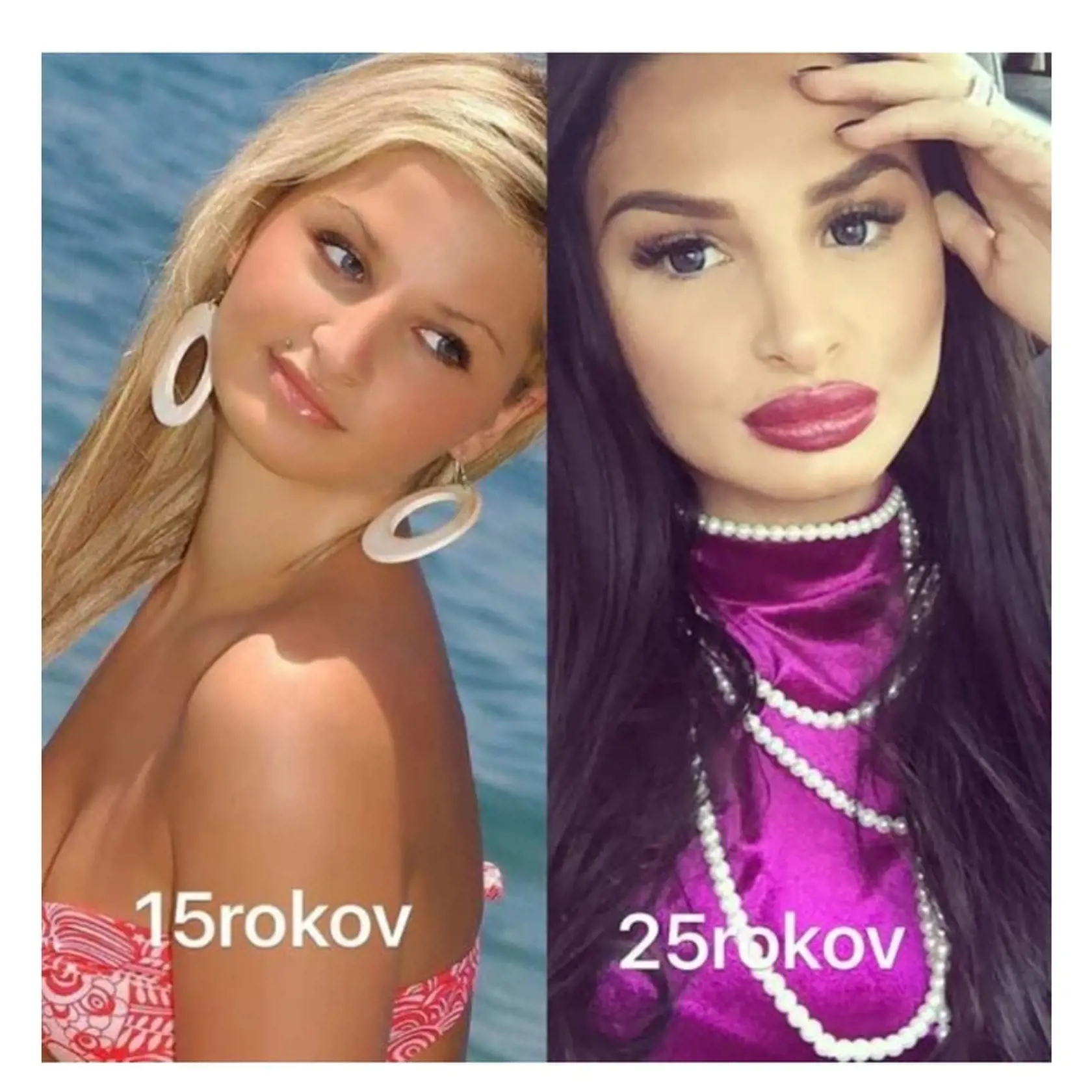 Plačková pred rokmi. Kedy vyzerala lepšie?