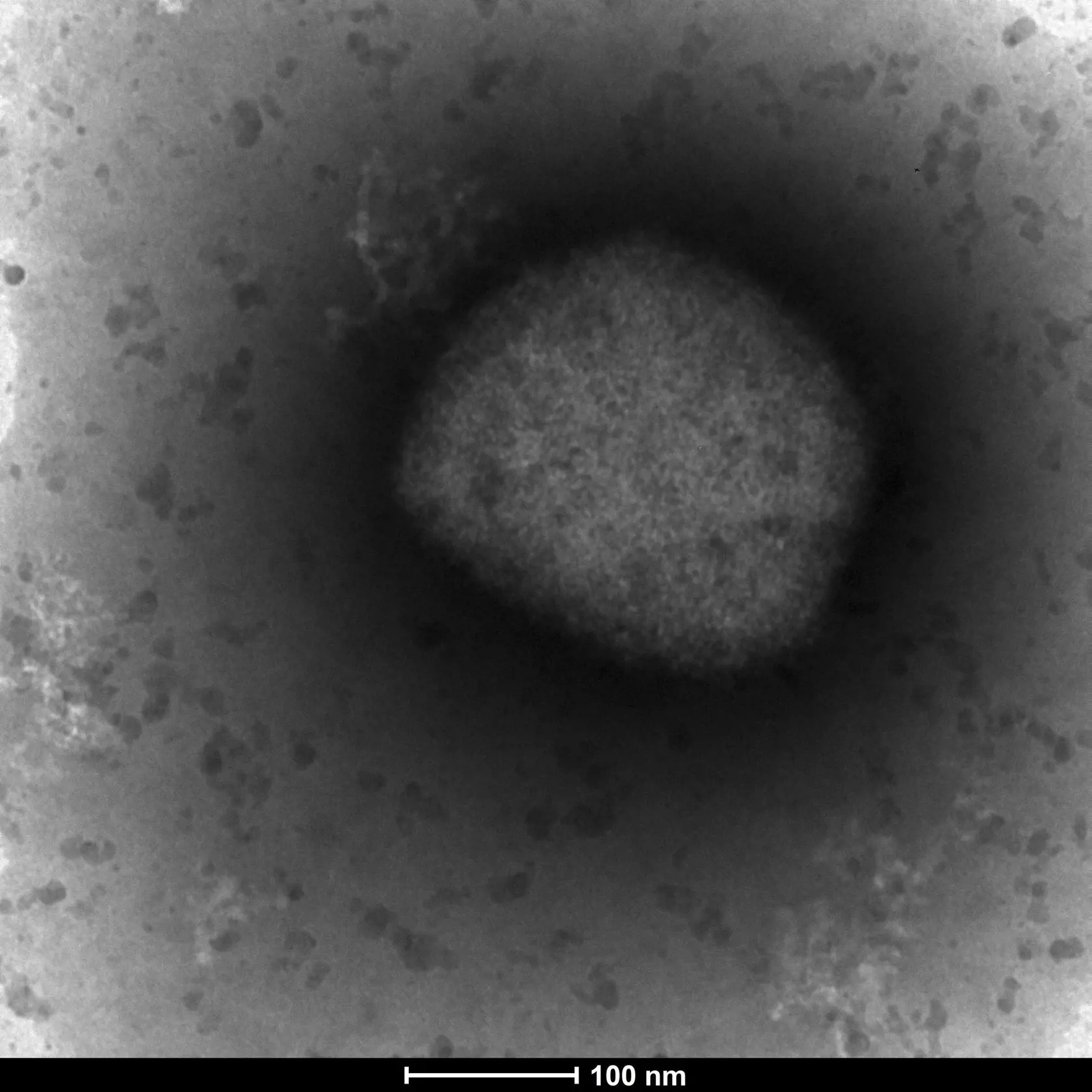 WA 13 Madrid -  Snímka z elektronického mikroskopu zobrazuje vírus opičích kiahní, ktorý pozoroval tím z laboratória arbovírusov a oddelenia genomiky a bioinformatiky Zdravotníckeho inštitútu Carlosa III. (ISCIII) v Madride. Španielsko zaznamenalo 25 nových prípadov opičích kiahní. Dovedna ich celkovo registruje už 84. Vo štvrtok to oznámilo španielske ministerstvo zdravotníctva.  Portugalsko, Spojené kráľovstvo a Španielsko sú v súčasnosti krajinami s najvyšším počtom prípadov opičích kiahní mi