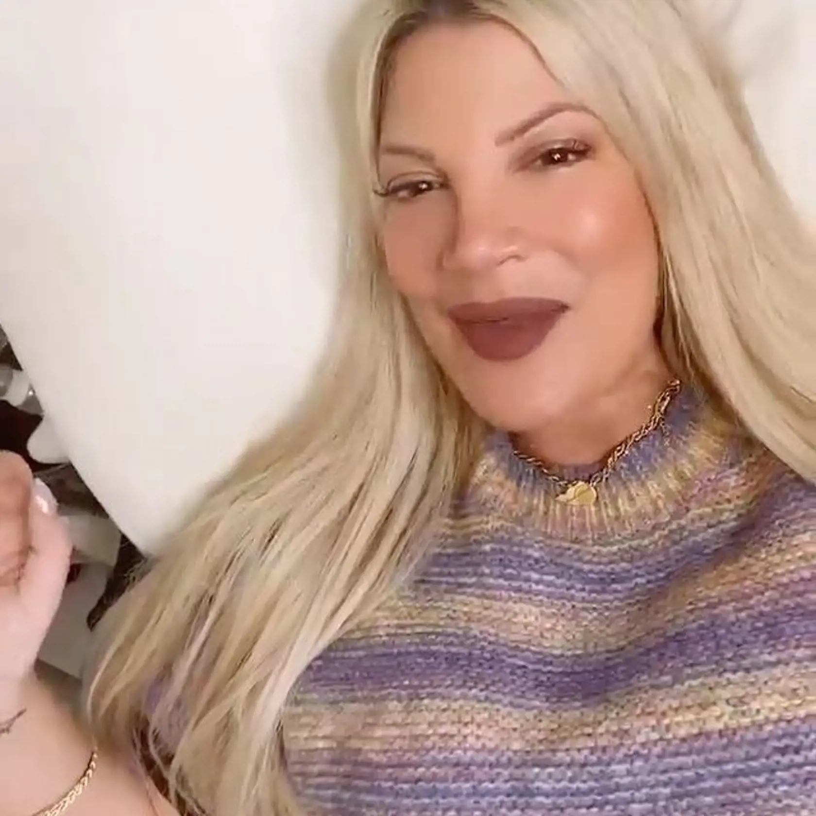 Tori Spelling podstúpila nespočet plastických zákrokov. Výsledok nie je najlepší.