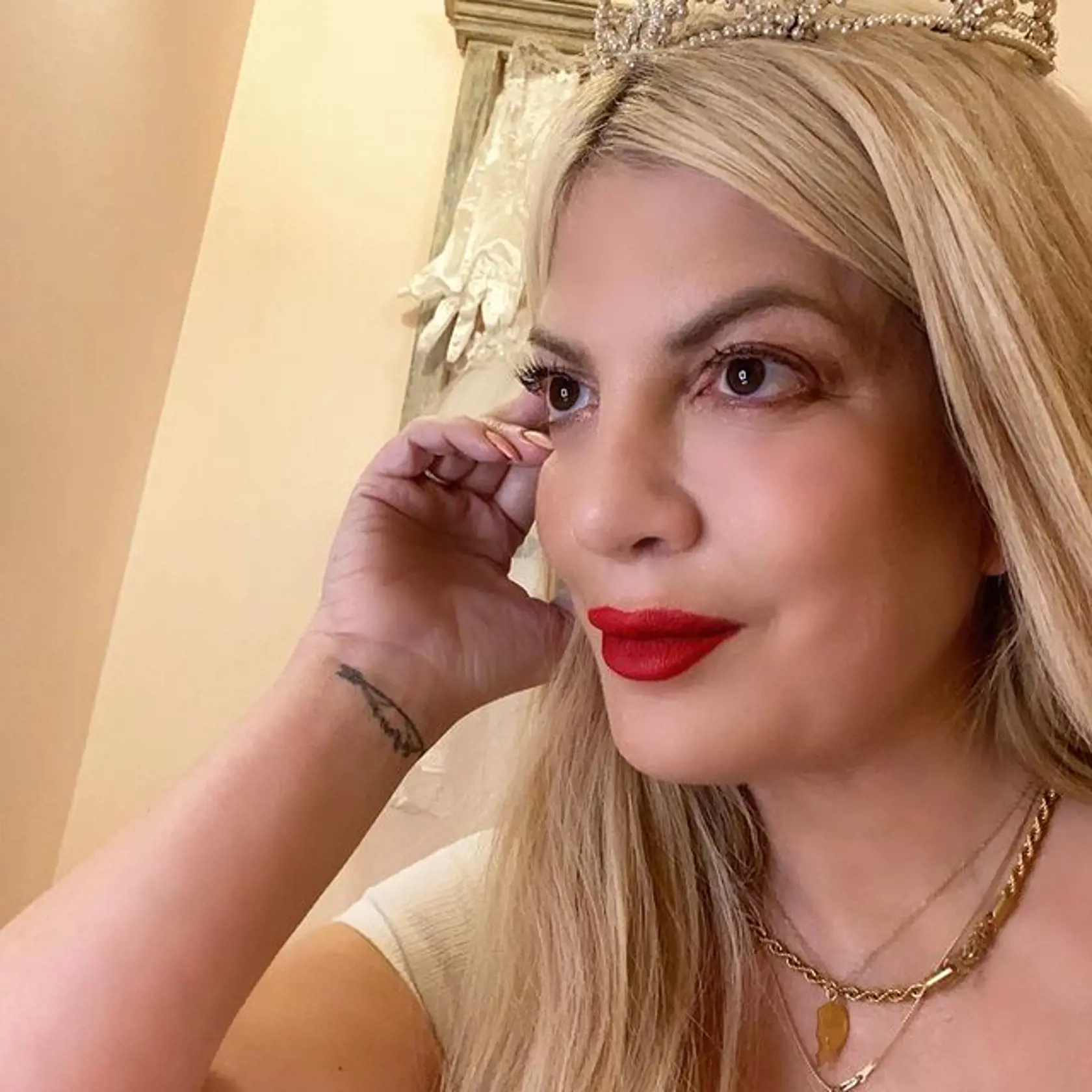 Tori Spelling podstúpila nespočet plastických zákrokov. Výsledok nie je najlepší.