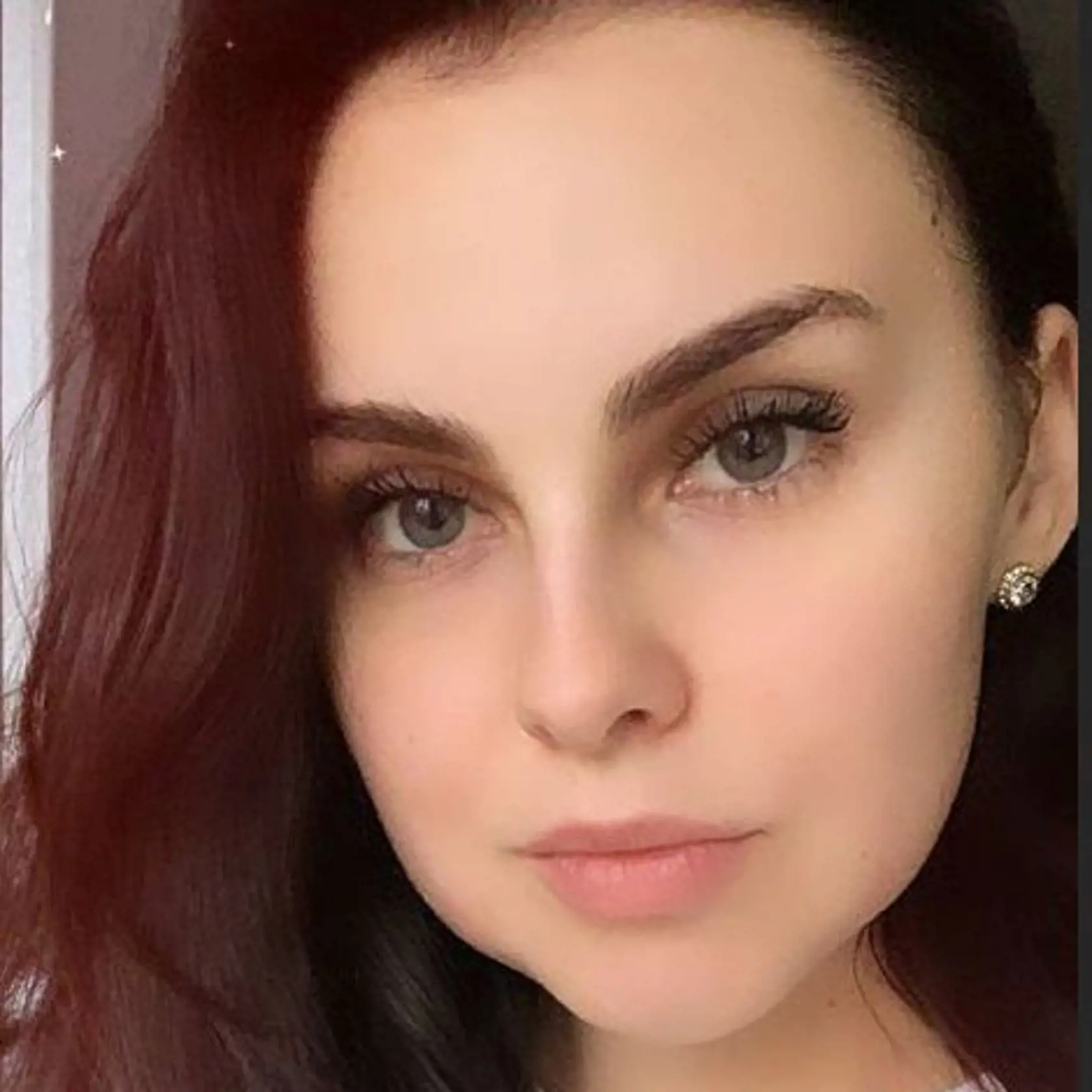 Brunetke opuchli obe líca.