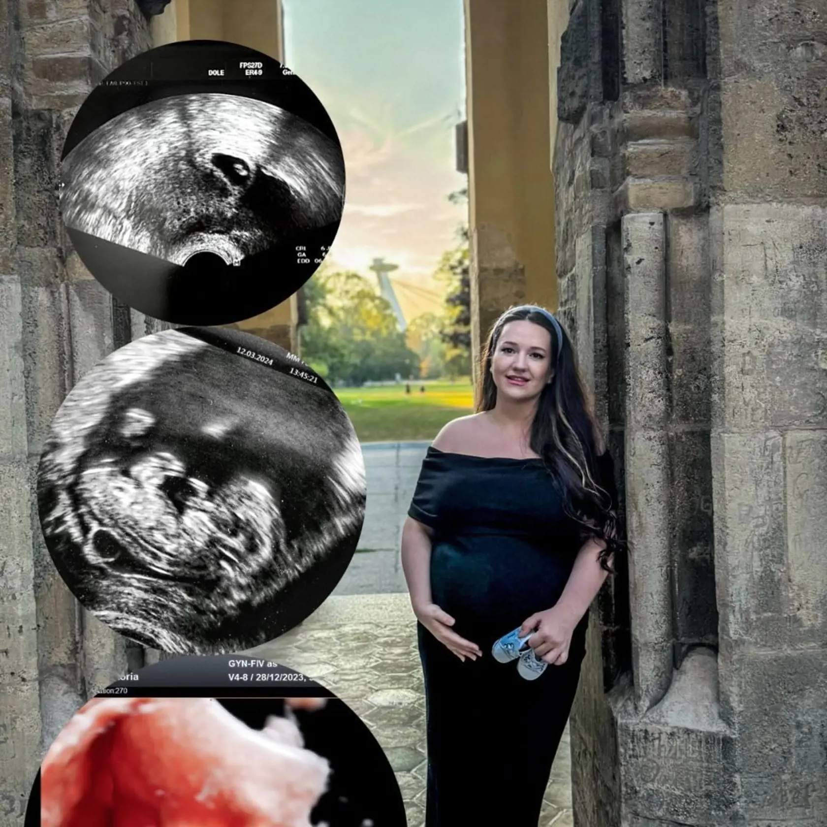 Viktória je po ťažkom pôrode v umelom spánku. Na Leonardka sa veľmi tešila. Teraz bojuje o život.