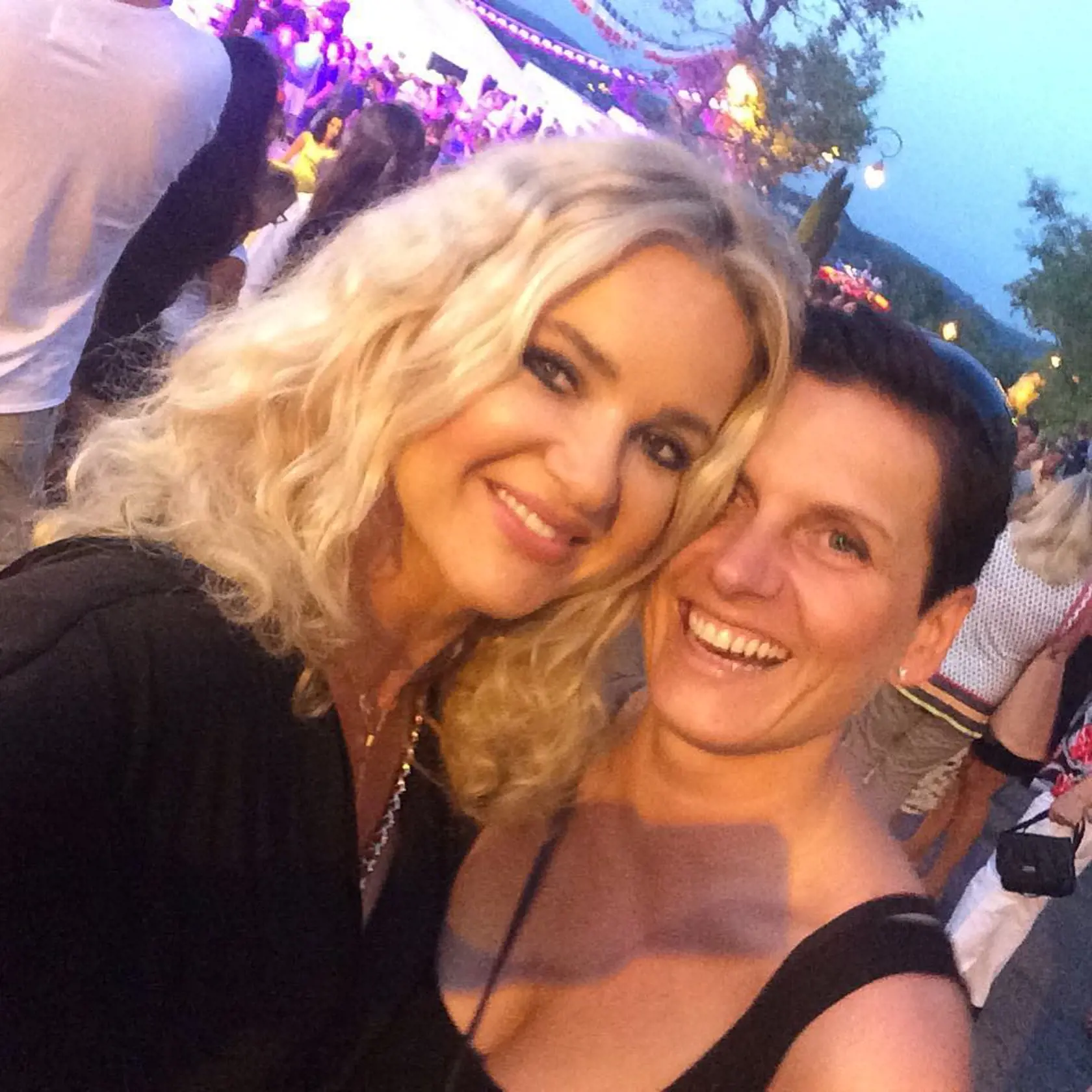 Monika Babišová v júni 201&ť mala prirodzené pery.