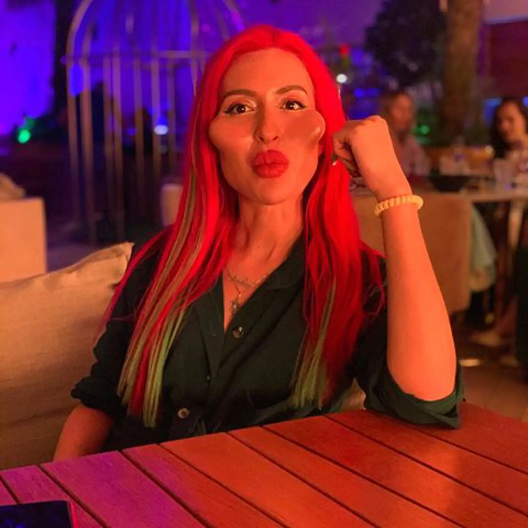 Anastasiia je Instagramová modelka, ktorá sa preslávila svojimi podivnými videami, v ktorých si vpichuje kyselinu hyalurónovú do pier a líc. Jej tvár má už od prirodzenosti poriadne ďaleko. Mnohým skôr však, ako krásnu ženu pripomína extrémnu karikatúru postavičky Jess Rabbit z animovaného filmu.