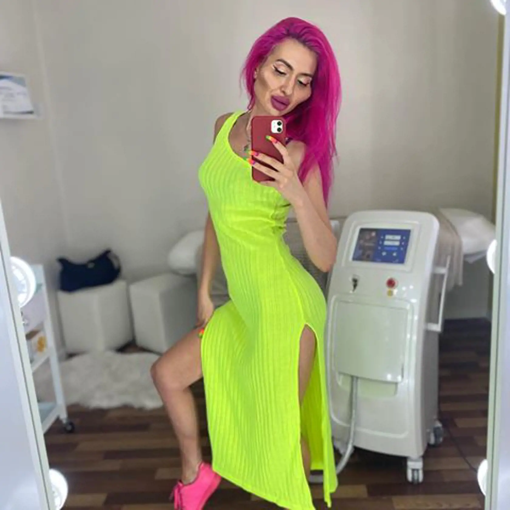 Anastasiia je Instagramová modelka, ktorá sa preslávila svojimi podivnými videami, v ktorých si vpichuje kyselinu hyalurónovú do pier a líc. Jej tvár má už od prirodzenosti poriadne ďaleko. Mnohým skôr však, ako krásnu ženu pripomína extrémnu karikatúru postavičky Jess Rabbit z animovaného filmu.