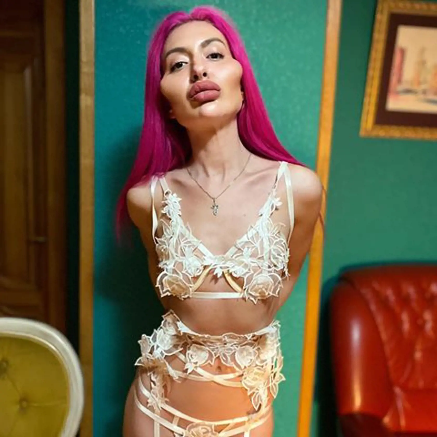 Anastasiia je Instagramová modelka, ktorá sa preslávila svojimi podivnými videami, v ktorých si vpichuje kyselinu hyalurónovú do pier a líc. Jej tvár má už od prirodzenosti poriadne ďaleko. Mnohým skôr však, ako krásnu ženu pripomína extrémnu karikatúru postavičky Jess Rabbit z animovaného filmu.