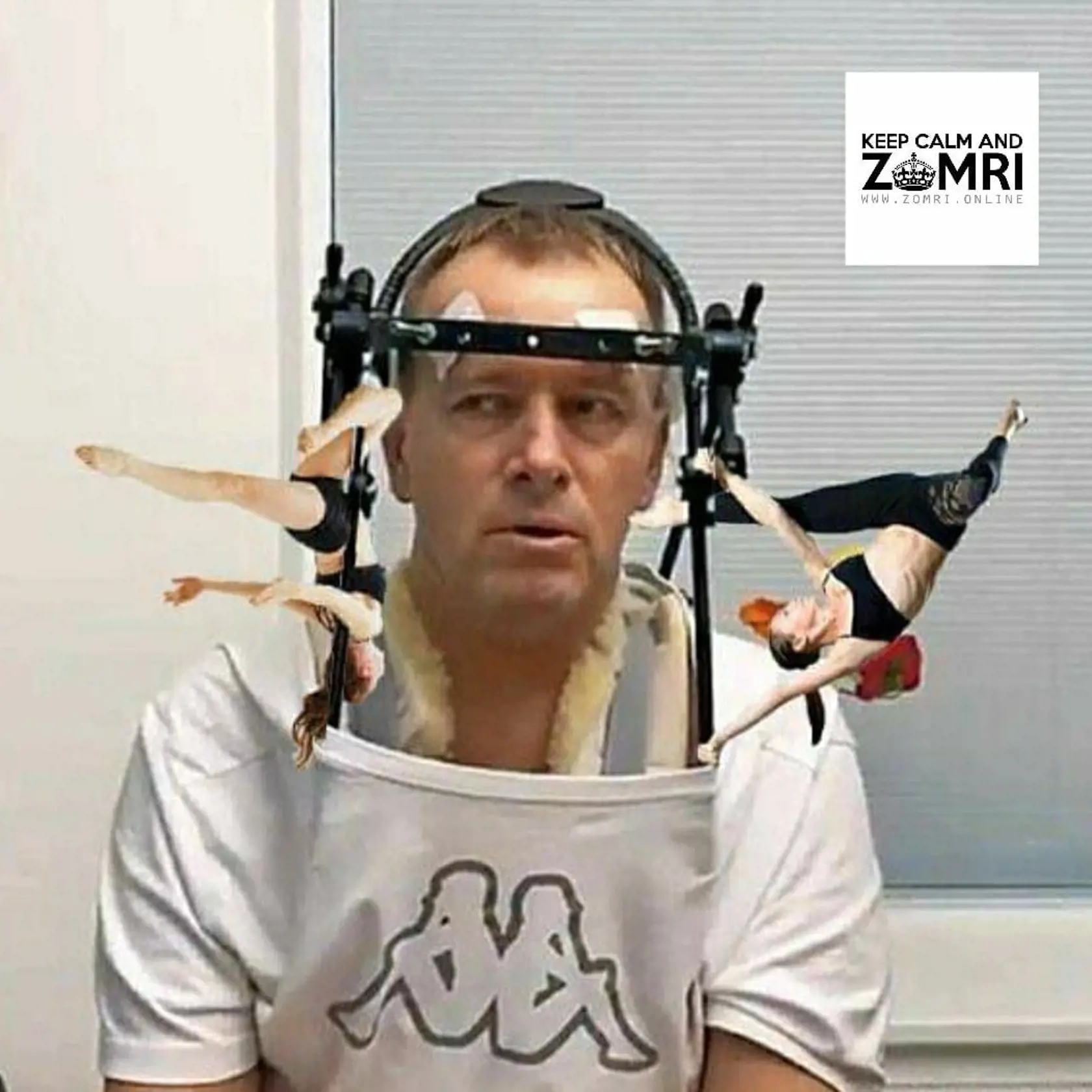 Známy milovník žien Boris Kollár si nejaký ten týždeň poležal v nemocnici. Zdravotníckou pomôckou ktorú musí používať je aj konštrukcia, ktorú nosí okolo hlavy. Na tej mu podľa vtipkárov tancujú sporo odeté ženy.