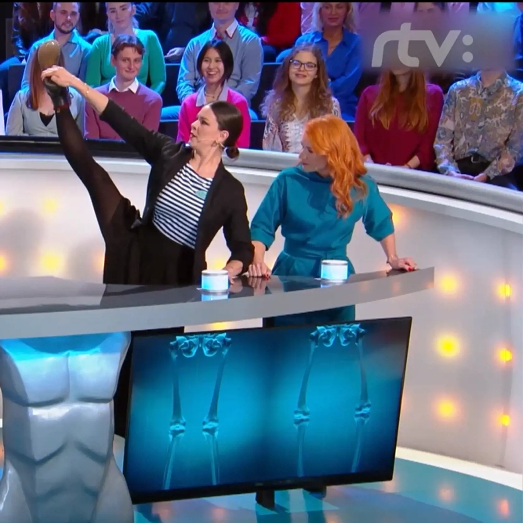 Hypermobilita, dedičstvo po babke z otcovej strany.