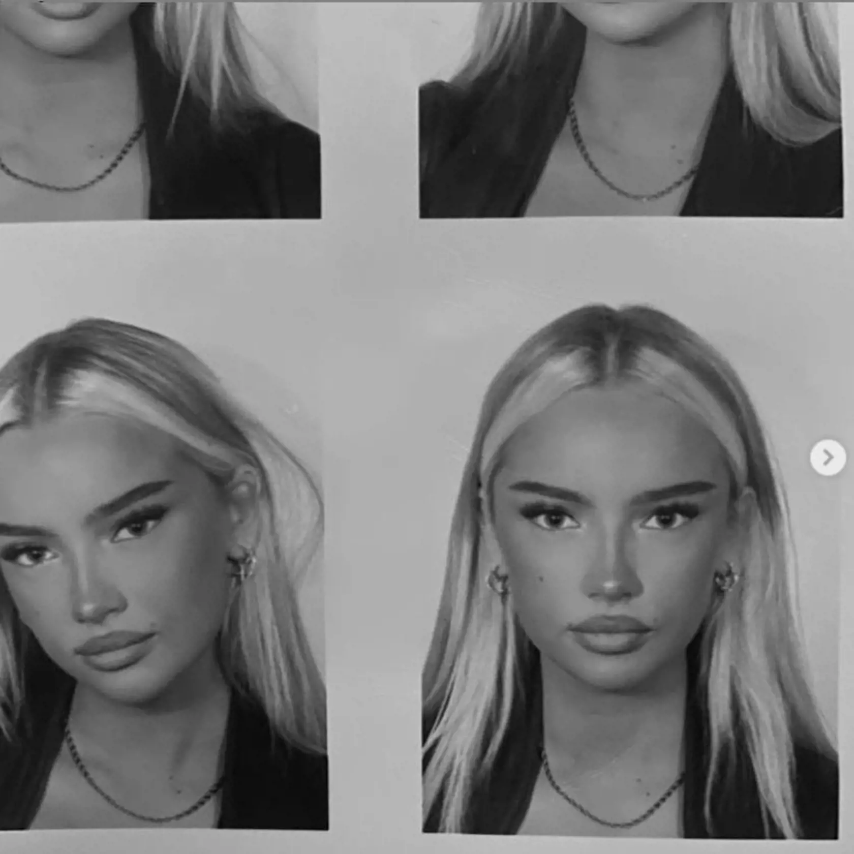 Emma Ellingsen (19) sa narodila ako muž. Keď mala 16 rokov, začala brať ženské hormóny.