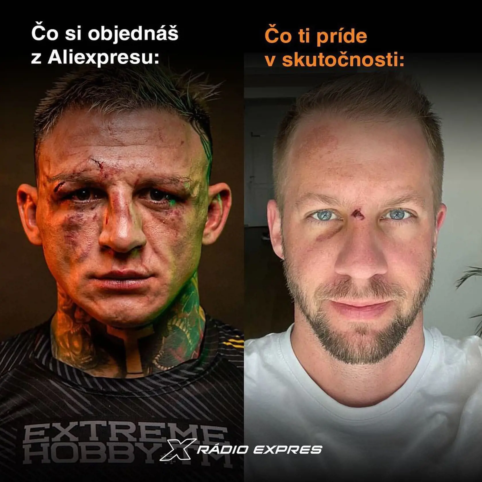 Matúš Krnčok si zranil nos.