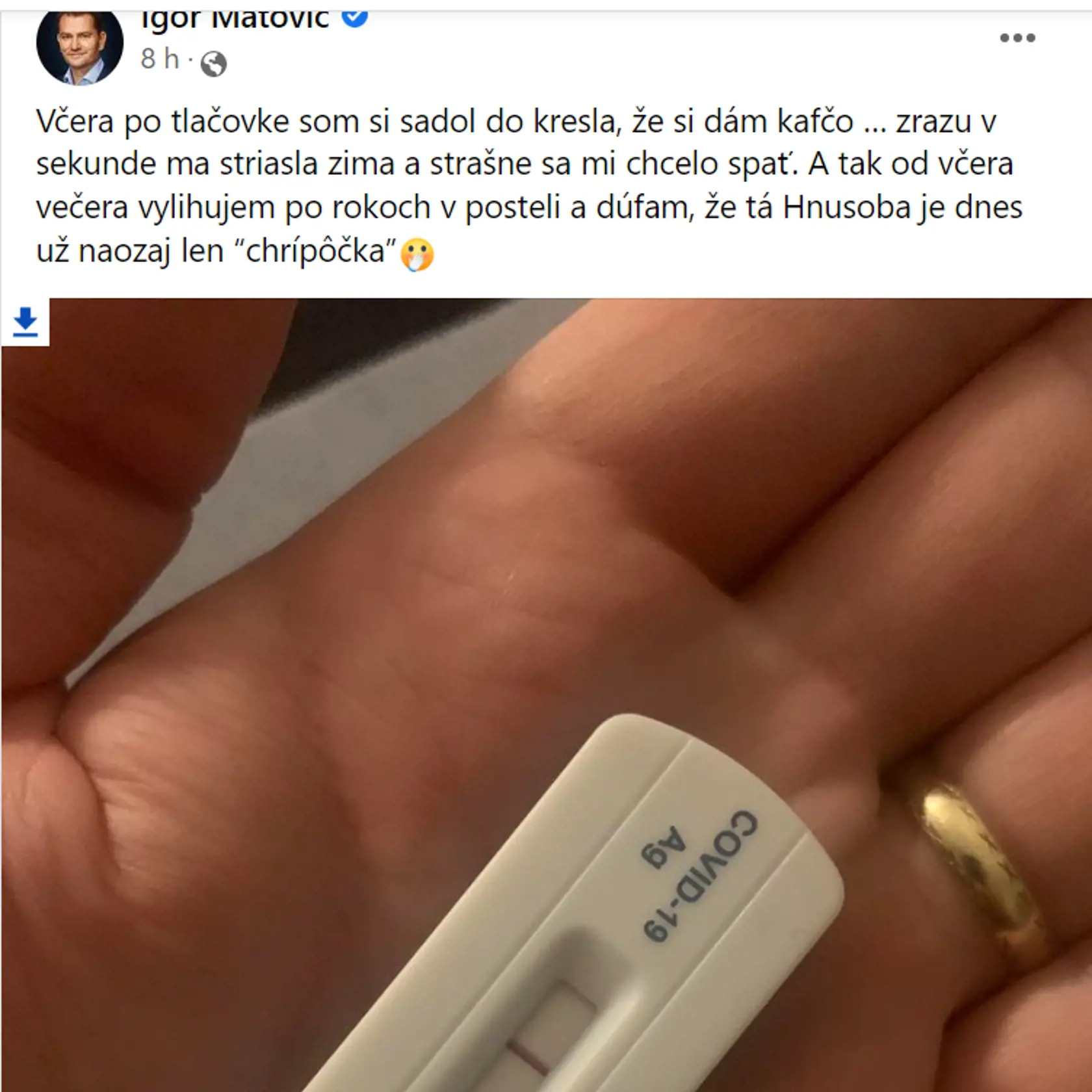 Igor Matovič je pozitívny na koronavírus.