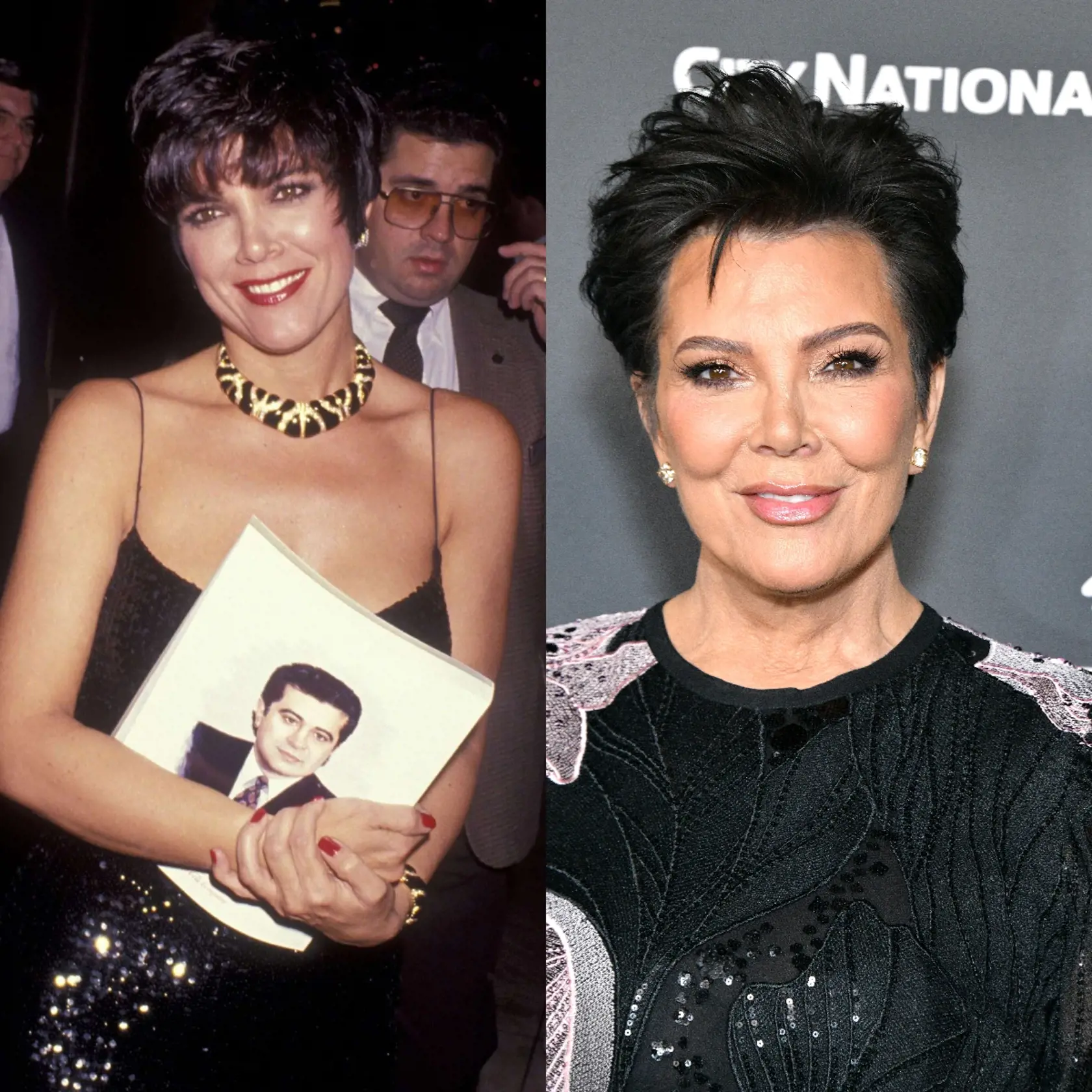 Nie je žiadnym prekvapením, že šéfka tímu Kardashian-Jenner má za sebou množstvo plastických operácií.