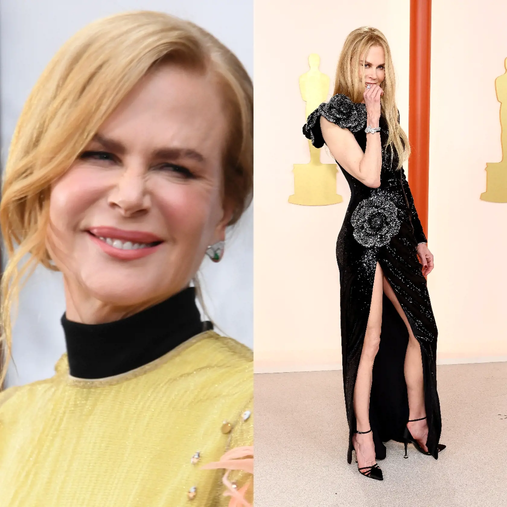 Herečka Nicole Kidman (55) síce na svoj vek nevyzerá, no najnovšie sa na Oscaroch predviedla s celkom zmenenou tvárou a divným správaním, ktoré pôsobilo podnapito. Okrem dokonalej postavy predviedla aj mladistvý vzhľad, ktorý zjavne nepatrí len matke prírode, ale aj šikovným rukám chirurga.