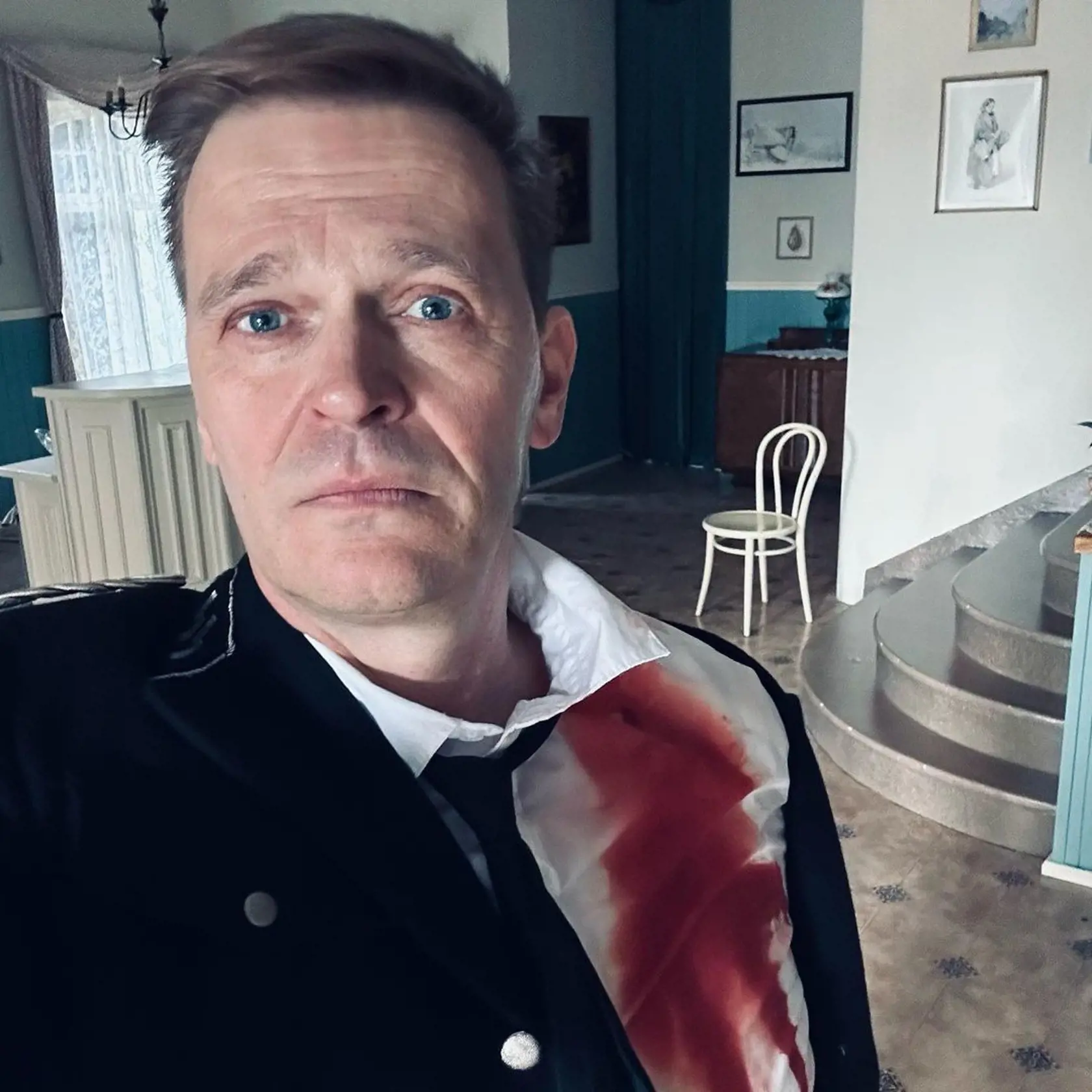 FOTO: Herec z Dunaja mal asi ŤAŽKÝ deň: Smutný, bledý, v ZAKRVAVENEJ košeli...Čo sa mu stalo?