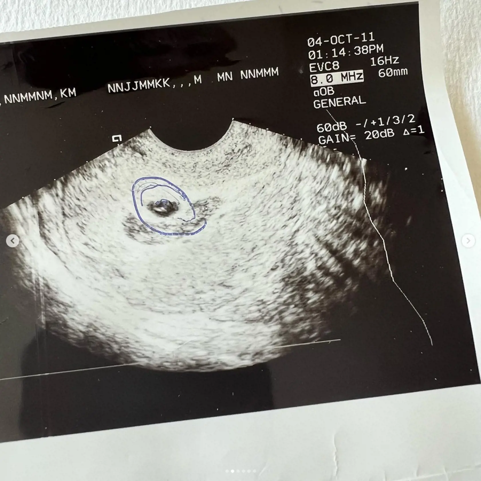 Mária sa podelila o snímku z prvého ultrazvuku, keď čakala dcéru Zoe.