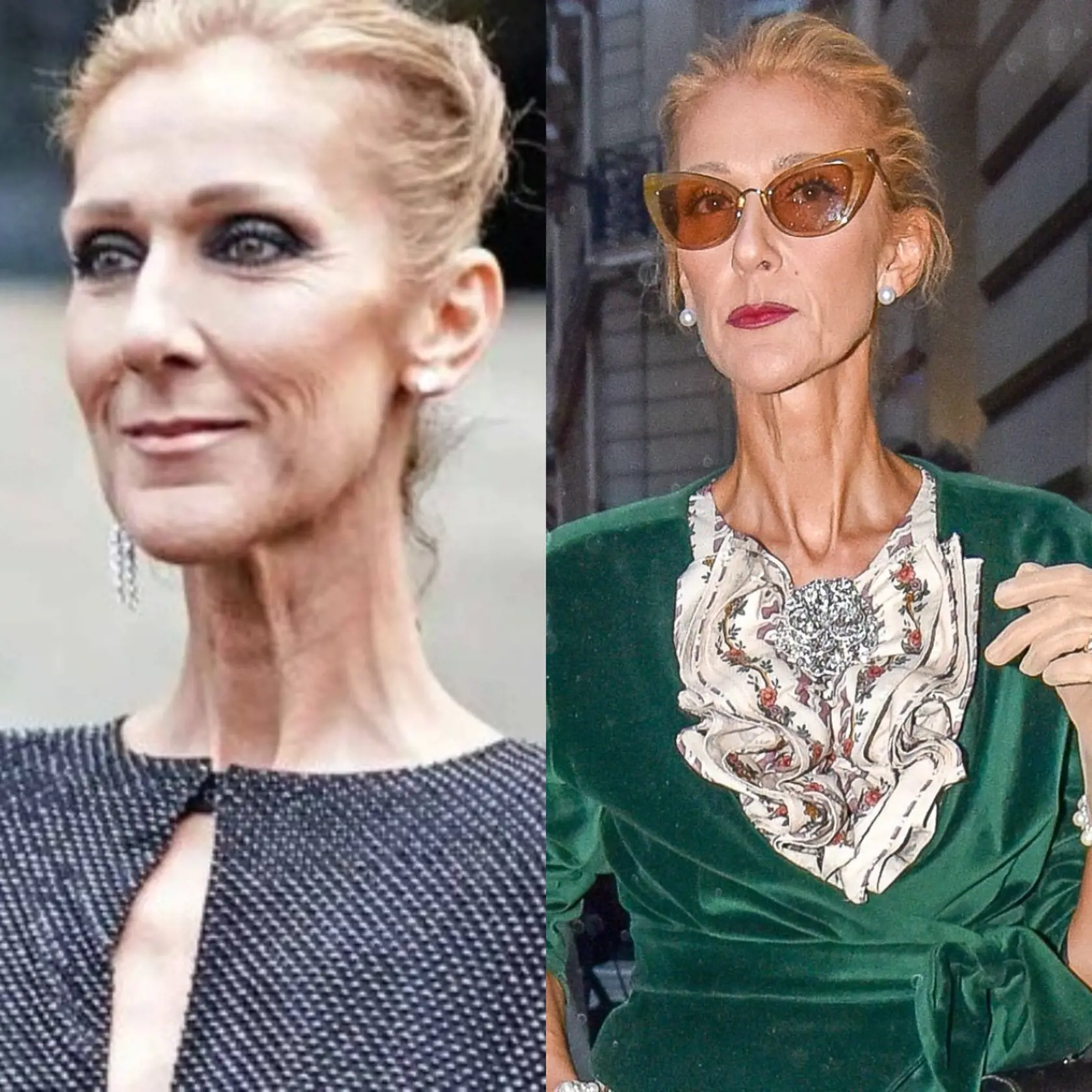 Ikonická spevácka diva a majiteľka jedného z najkrajších hlasov vôbec Céline Dion (55) zrušila svoje svetové turné Courage. Dôvodom majú byť opäť zdravotné problémy spojené so Syndrómom stuhnutého človeka. Dočkáme sa tak ešte jej legendárnych vystúpení?