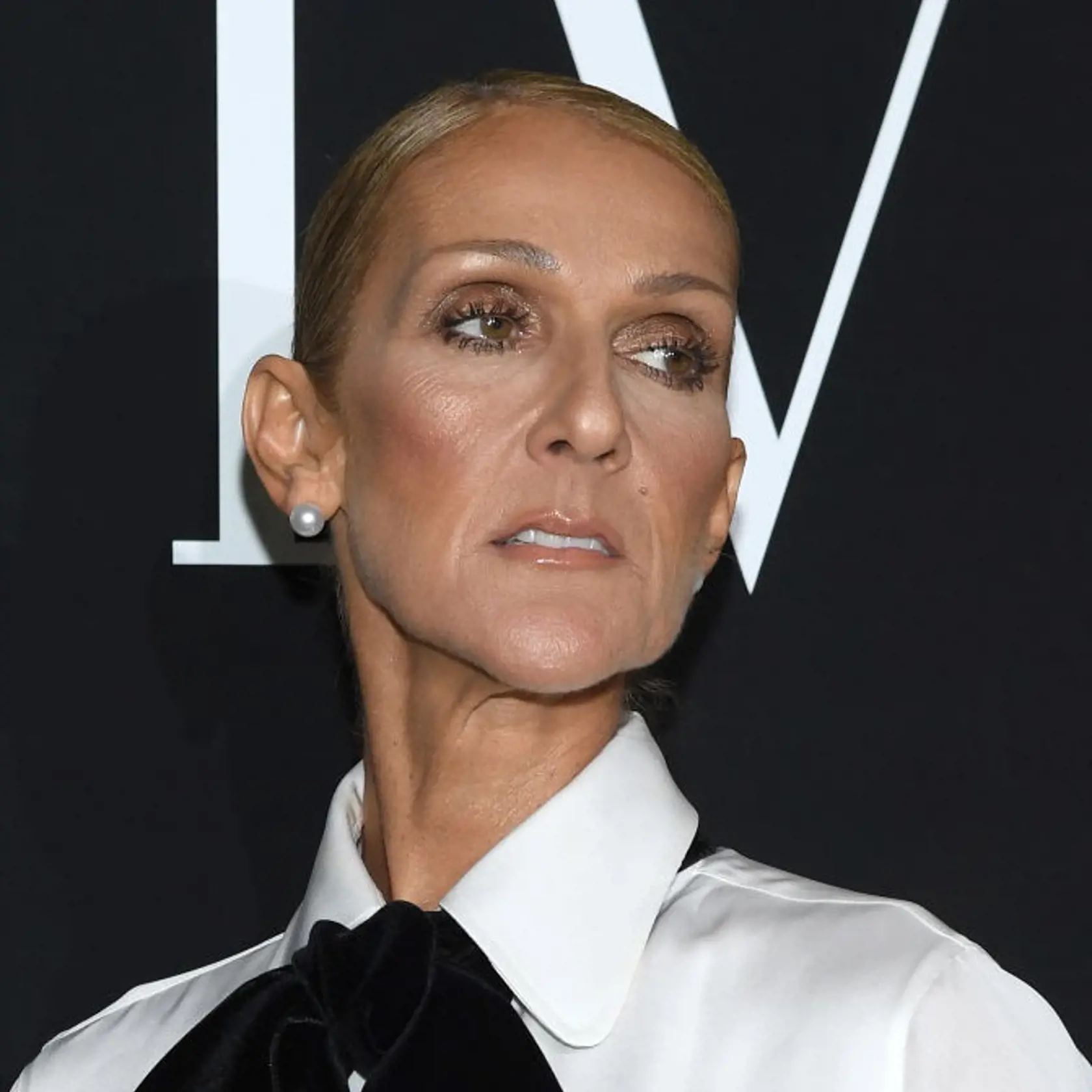 Speváčka Céline Dion sa už koncom minulého roka zverila svojím fanúšikom, že trpí syndrómom stuhnutého človeka (SPS), ktorý napáda aj jej hlasivky a mimiku tváre. Ochorenie žiaľ nie je liečiteľné, pomocou liekov a špeciálnych cvičení sa však dá spomaliť.