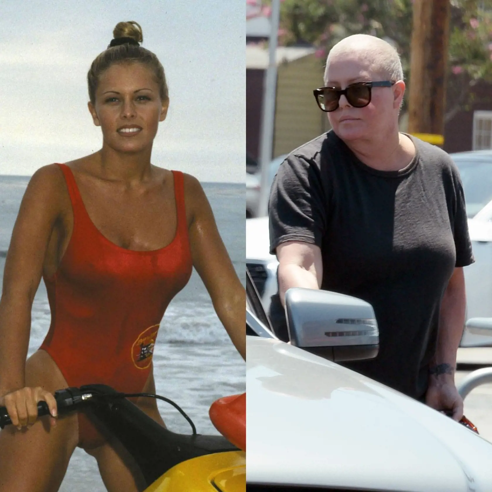 Herečka Nicole Eggert v roku 1993 a teraz, keď zvádza nerovný boj s agresívnou formou rakoviny prsníka.