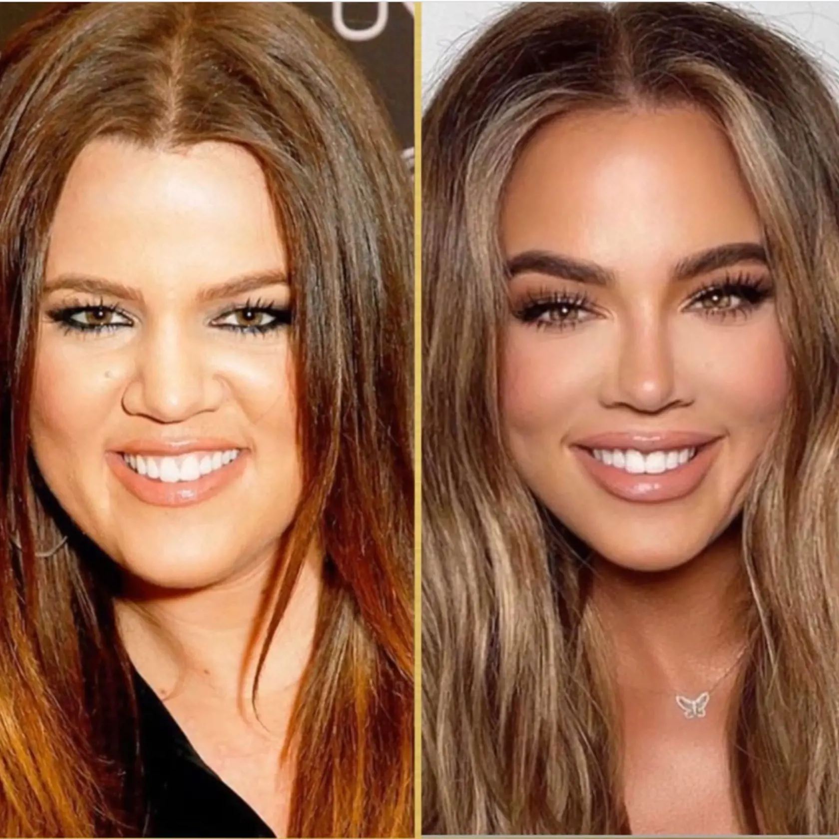 Khloé Kardashian podstúpila najradikálnejšiu premenu.