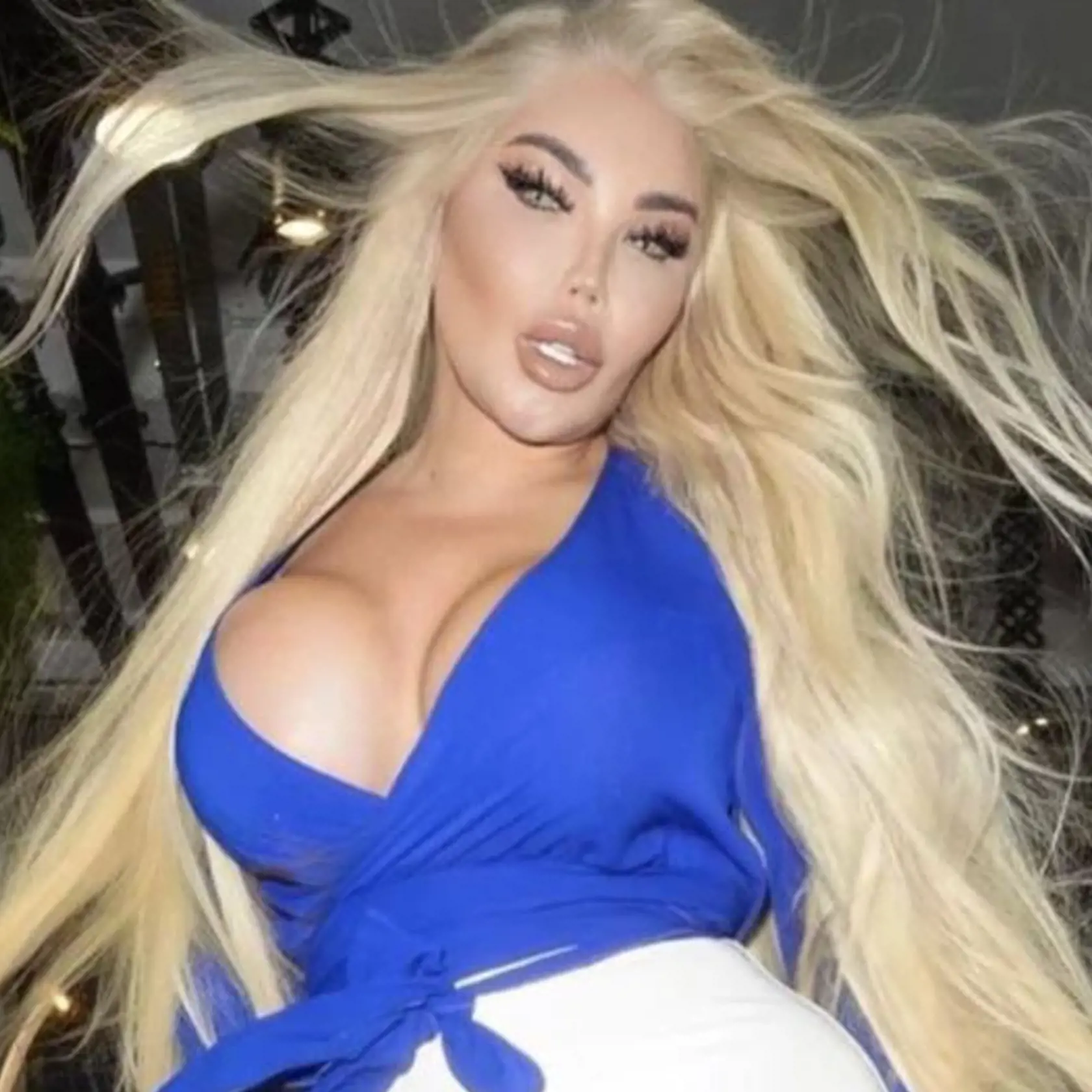 Svoje nové a štíhlejšie telo predviedla živá Barbie v uliciach Londýna po návrate z Turecka.