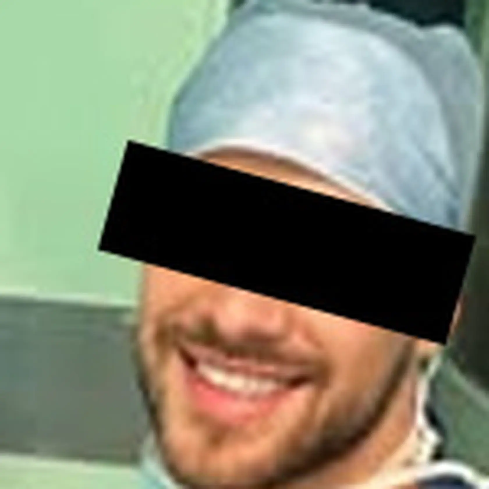 Ďalší lekár s nedovolenou látkou! Je to už mesiac, čo sa prevalil škandál s lekárom na klinike plastickej chirurgie v UNB Ružinove, ktorý vykonával jednoduchý chirurgický zákrok pod vplyvom omamných látok. Riaditeľ nemocnice nariadil toxikologické vyšetrenie ďalších lekárov. Výsledok testovania nemilo prekvapilo vedenie nemocnice.
