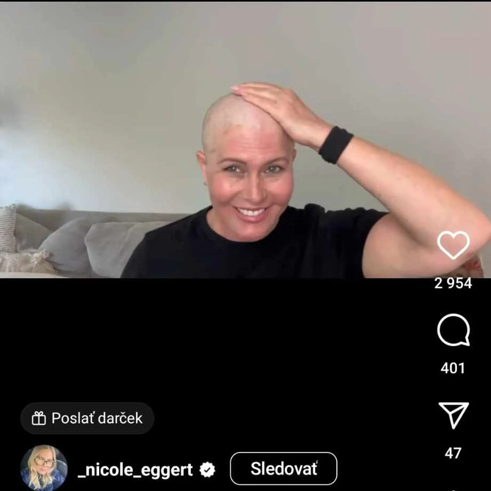 Nicole tesne po oholení hlavy
