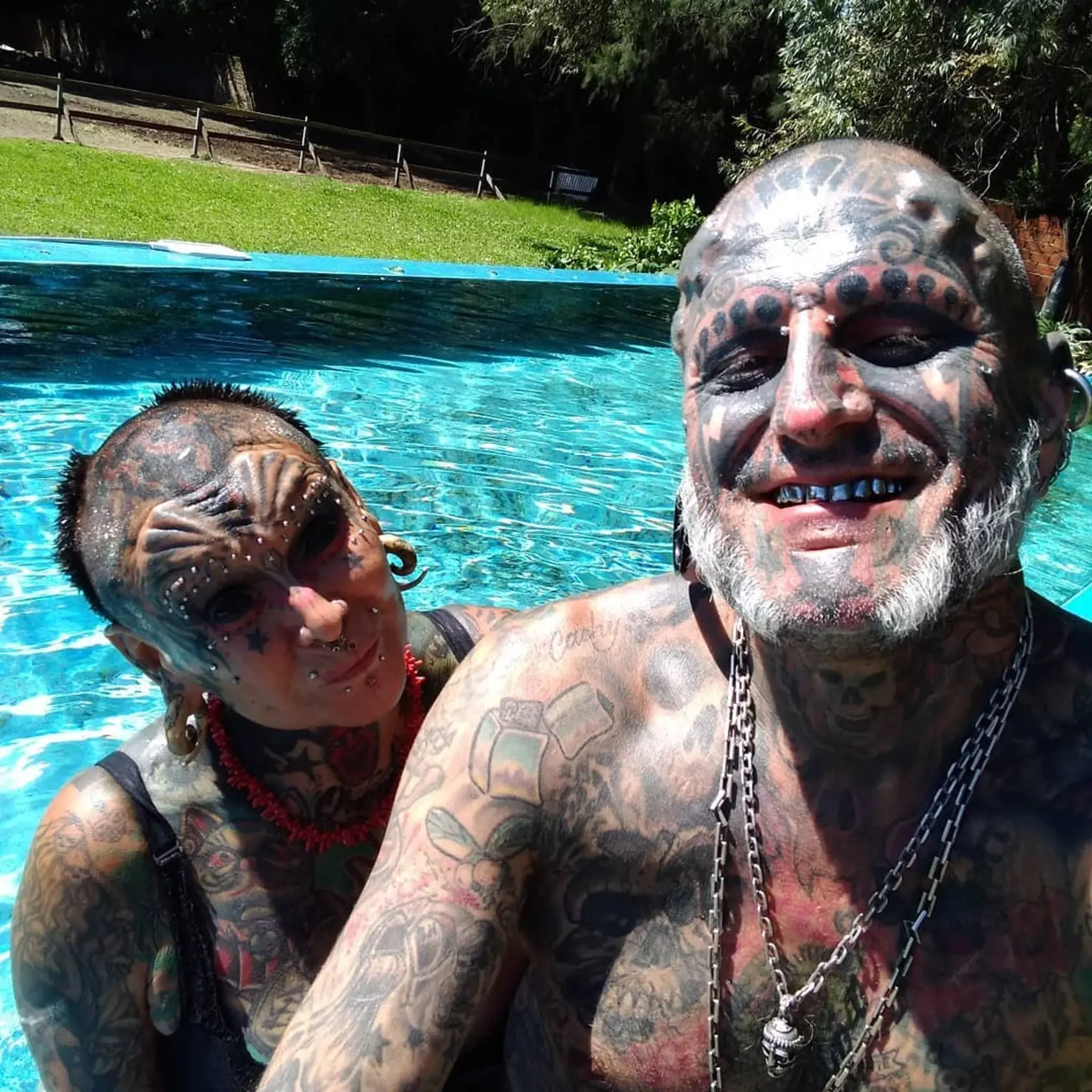 EXCLUSIVE: One half of extreme body mod couple called 'cherubs from hell' gets implants to make arms bigger