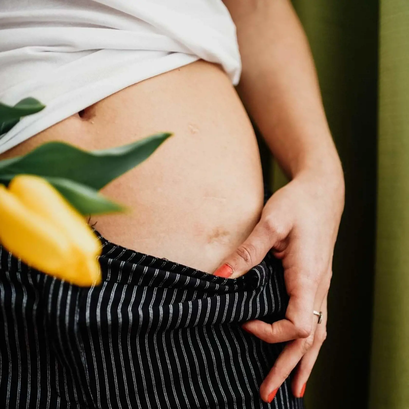 Mária má endometriózu
