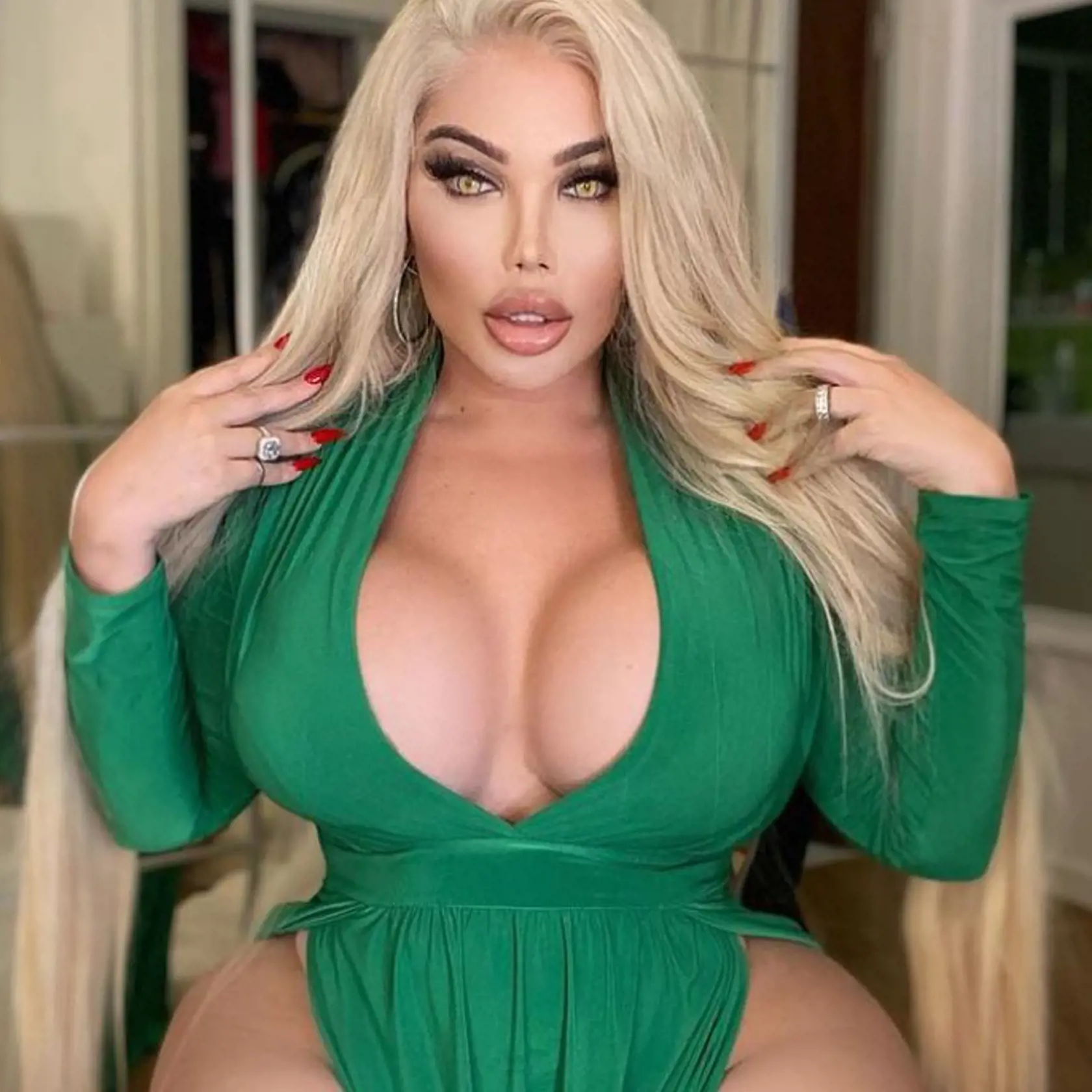 Po tom, ako podstúpila zmenšenie žalúdka, sa dostavili prvé výsledky a zo 102 kilovej živej Barbie ostala polovica.