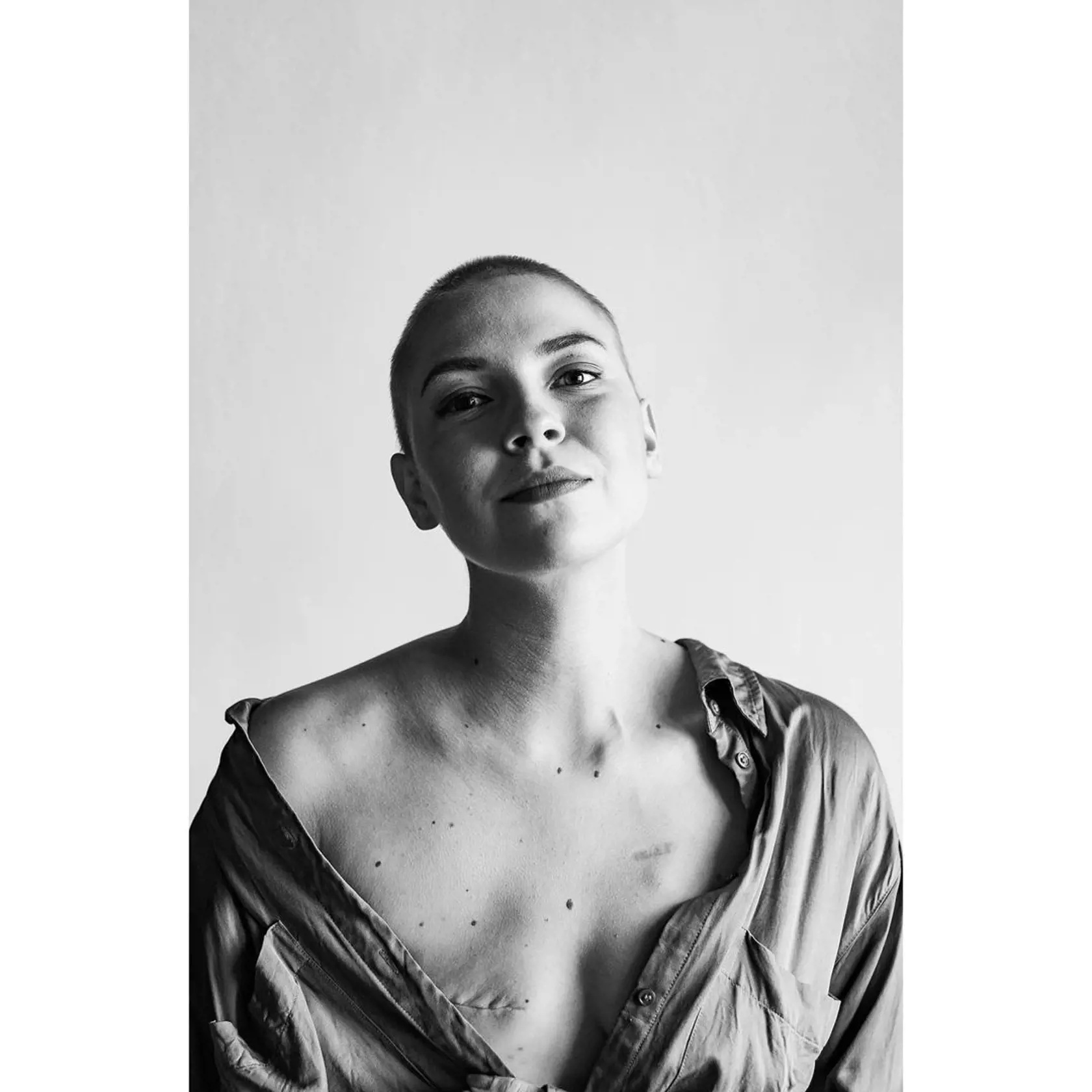 Patrícia Janečková zverejnila fotku s jazvou.