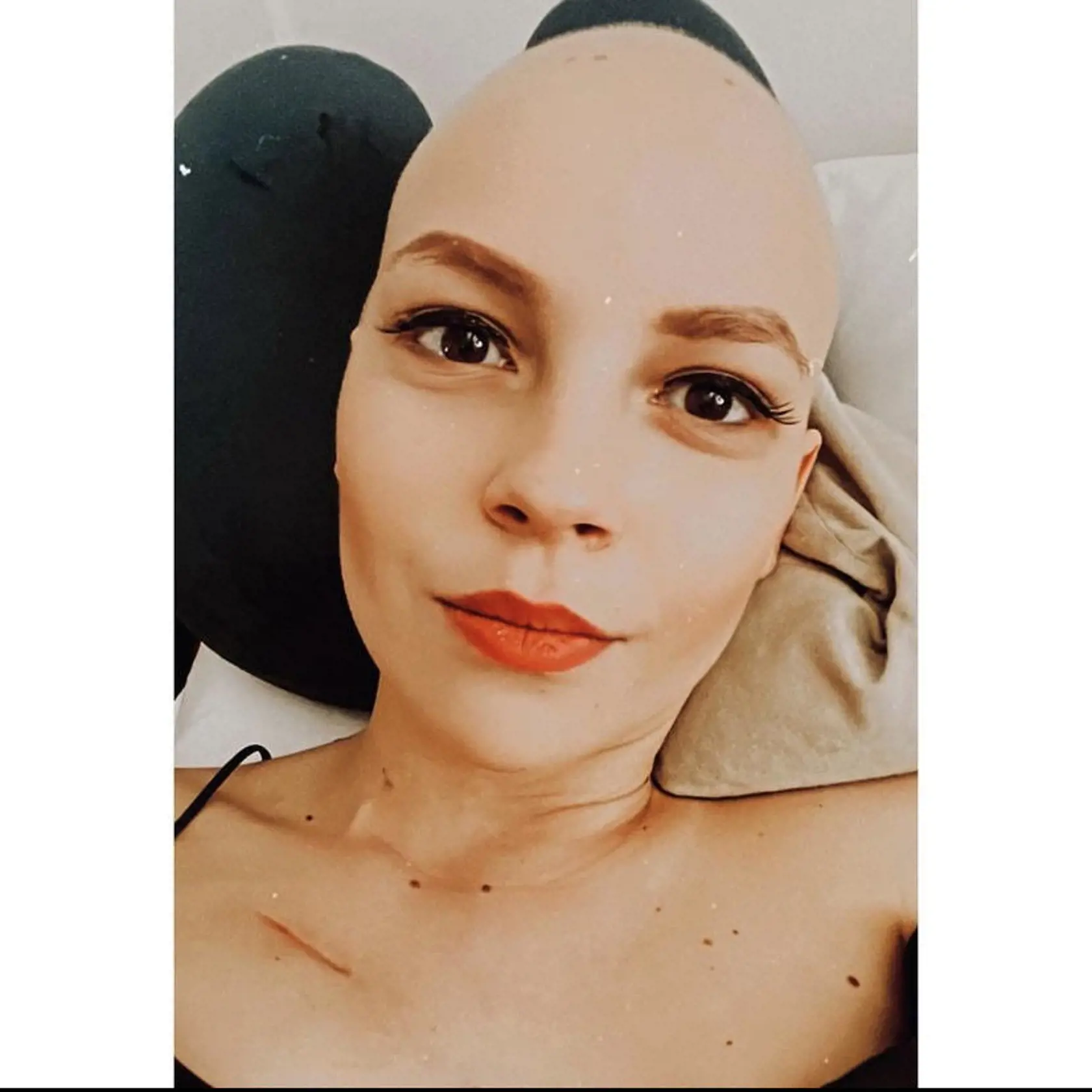 Patrícia statočne bojuje so zákernou chorobou.