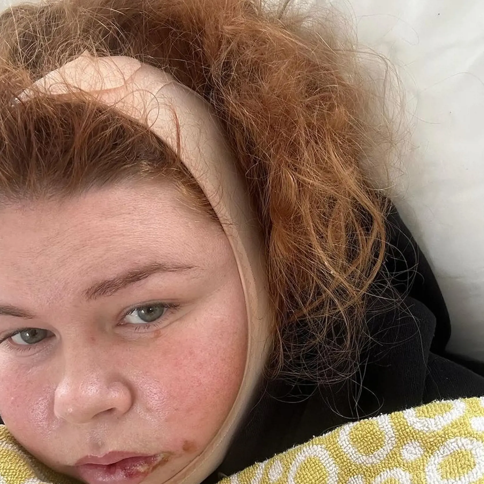 Evelyn má za sebou vážnu operáciu