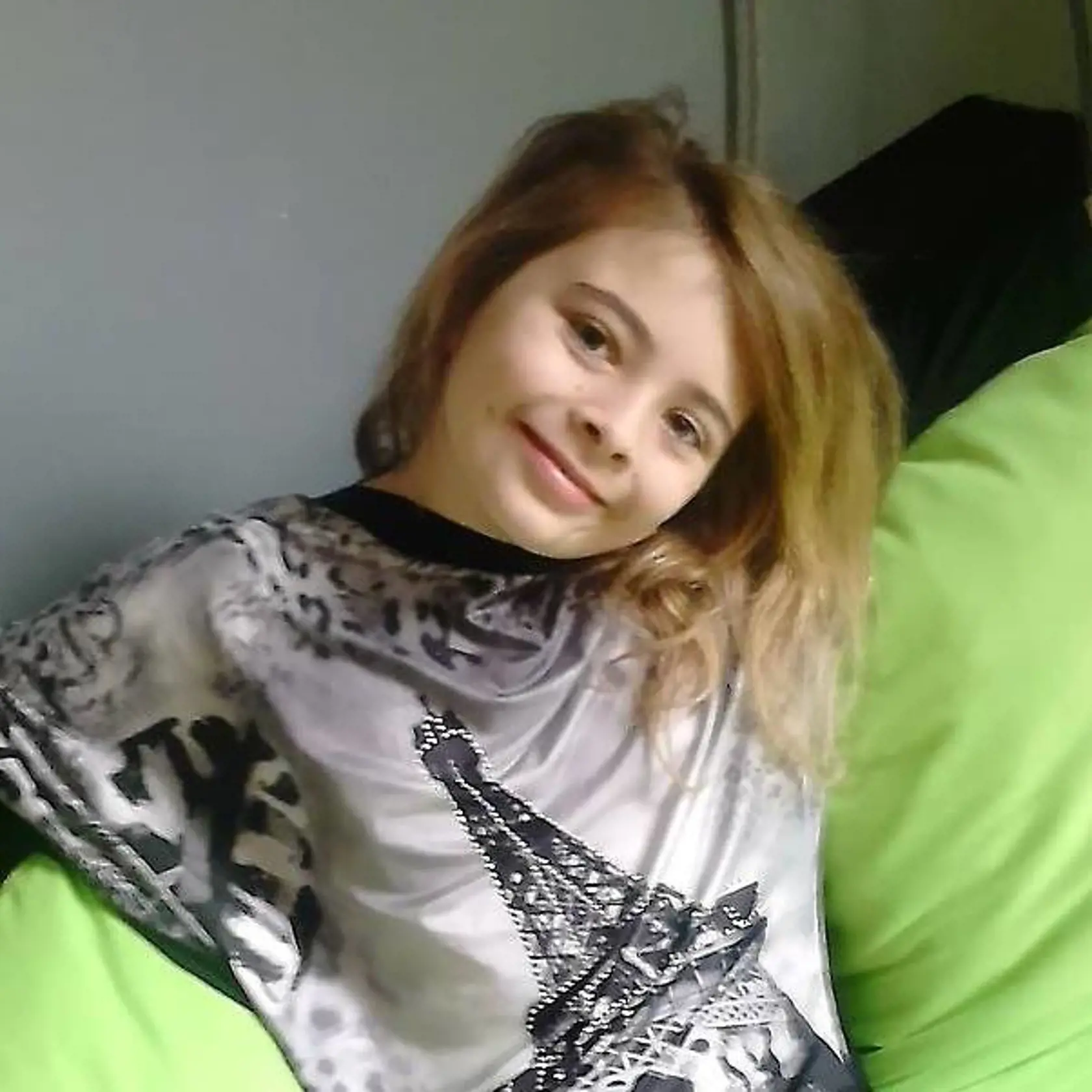 Vaneska potrebuje akútne darcu obličky, ktorý má krvnú skupinu 0.