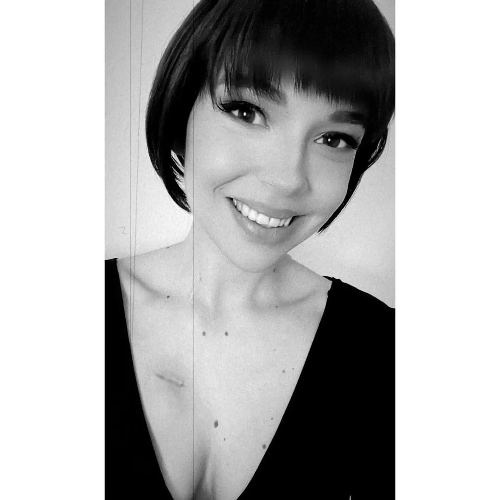 Patrícia Janečková prehrala boj s rakovinou prsníka.