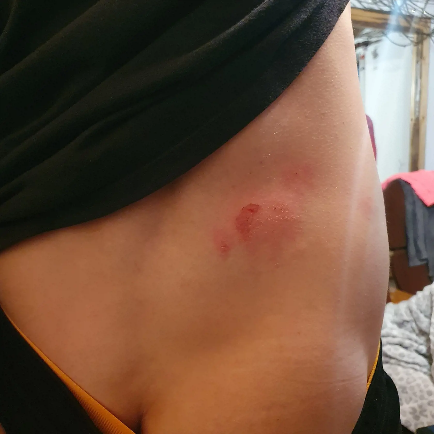 Mladík sa pochválil aj poranením na zadnej časti tela.