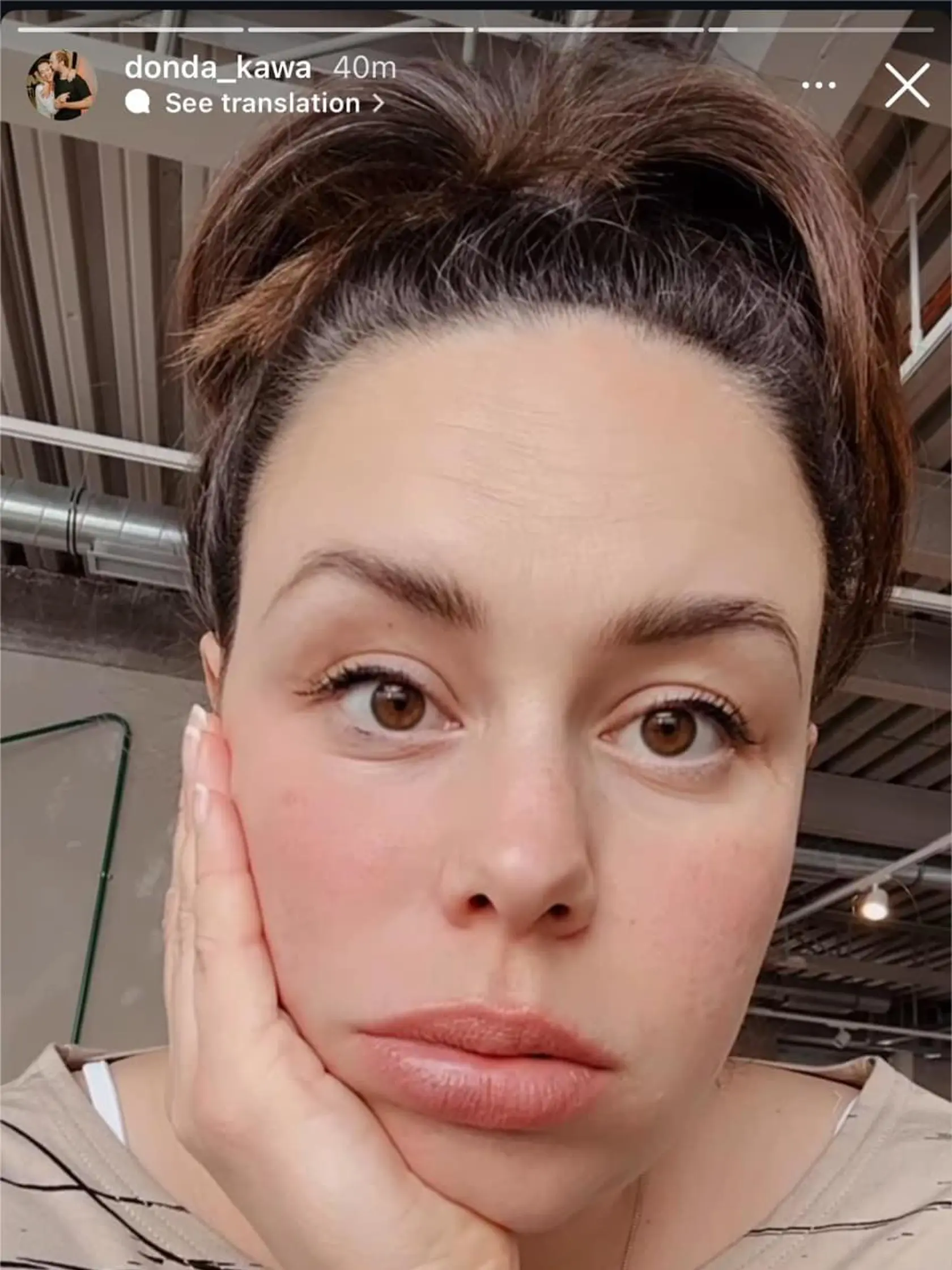 Dominika Kavaschová ukázala zmenú tvár pred pôrodom.