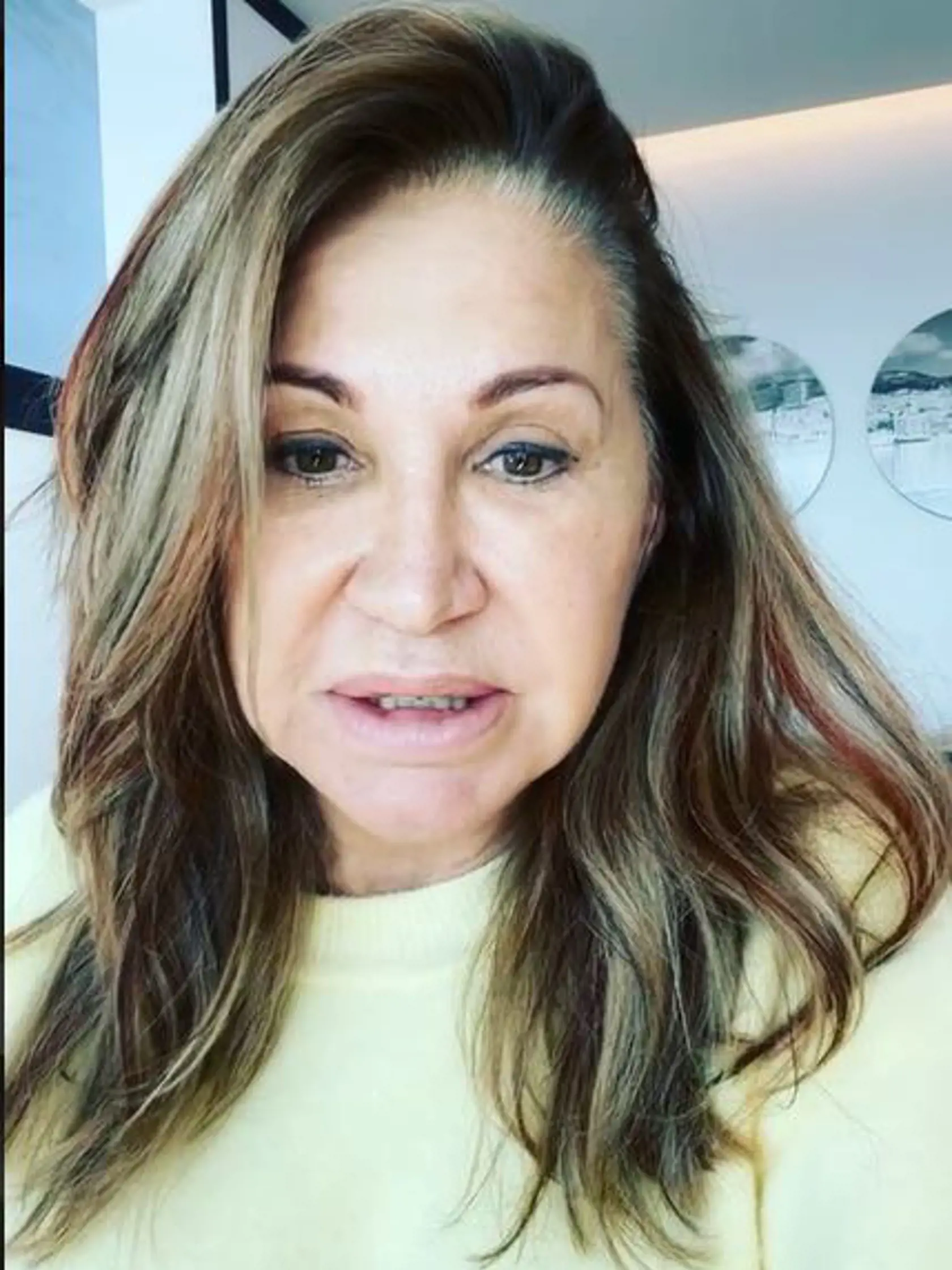 Video nenalíčenej Carmen vzniklo v nemocnici. "Dnes deň bez mejkapu," napísala milionárka k zverejneným záberom.