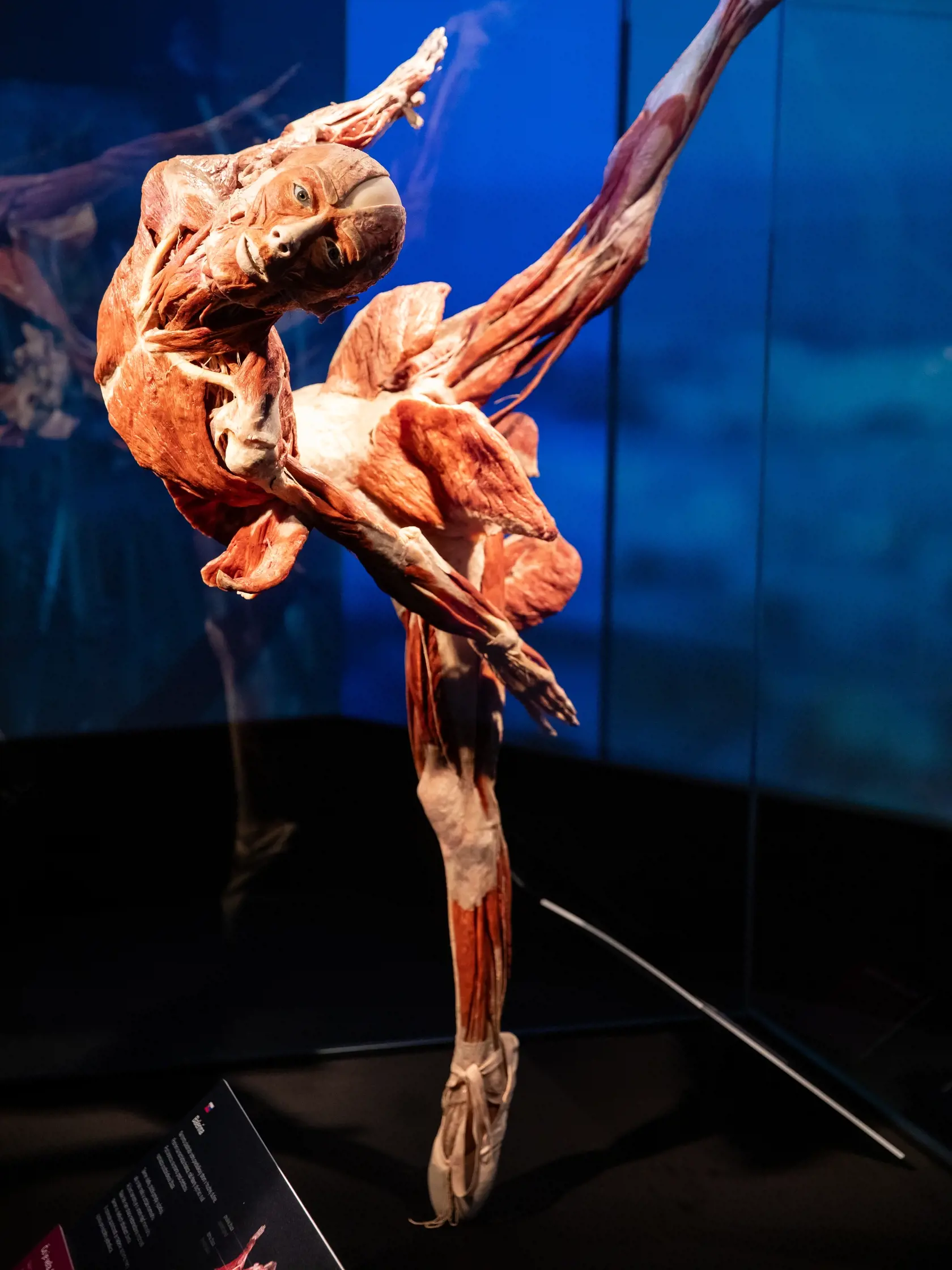 V piatok 13.10. začala v bratislavskom  nákupnom centre Nivy podľa viacerých odborníkov a mimovládnych organizácii kontroverzná výstava Body Worlds.