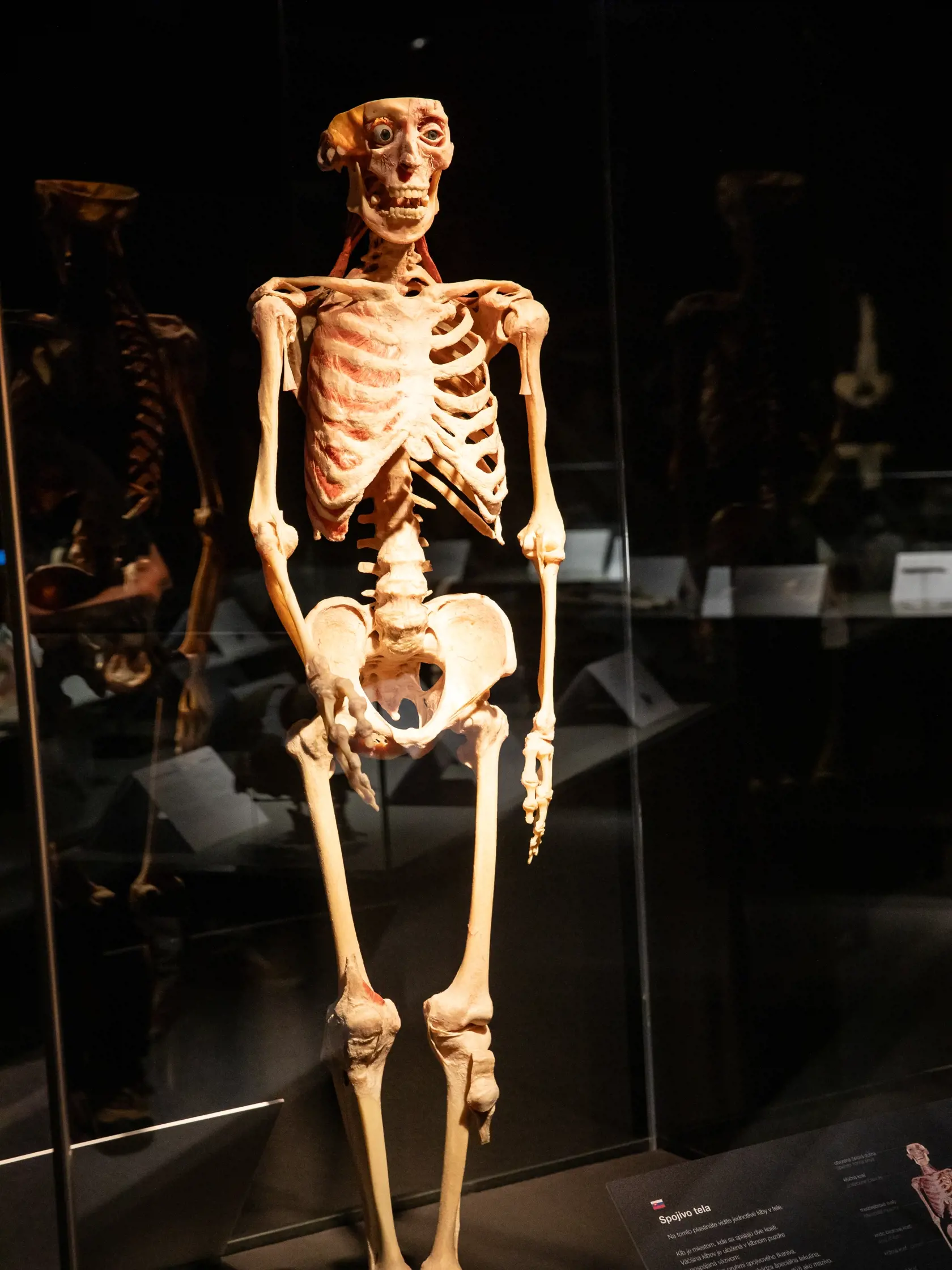 V piatok 13.10. začala v bratislavskom  nákupnom centre Nivy podľa viacerých odborníkov a mimovládnych organizácii kontroverzná výstava Body Worlds.