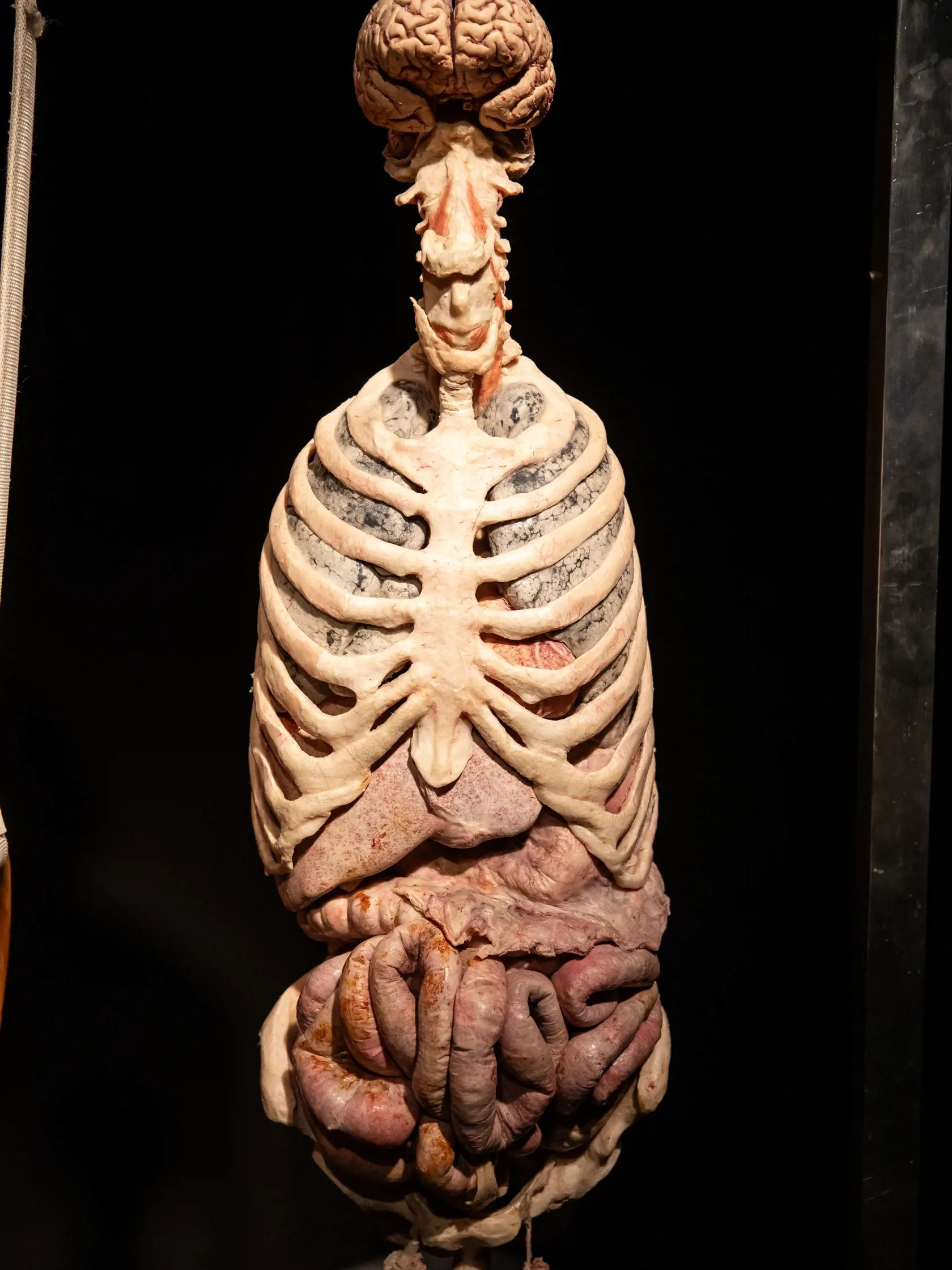 V piatok 13.10. začala v bratislavskom  nákupnom centre Nivy podľa viacerých odborníkov a mimovládnych organizácii kontroverzná výstava Body Worlds.